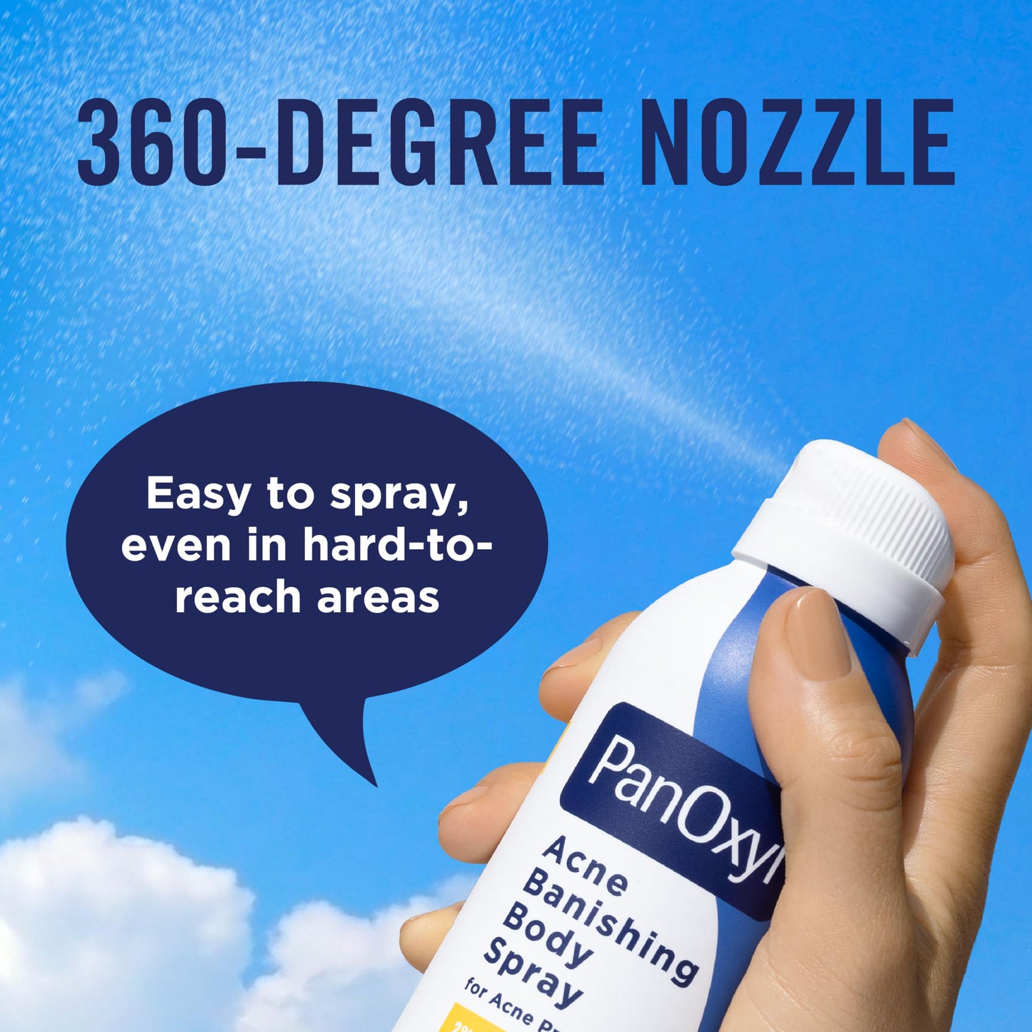 PanOxyl Acne Banishing Body Spray with 2% Salicylic Acid, Pimple Treatment Spray to Clear Stubborn Breakouts, 360-Degree Spray Nozzle Beauty and Personal Care PanOxyl