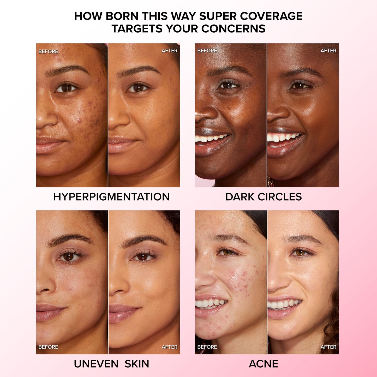 Too Faced Born This Way Super Coverage Multi-Use Concealer | Full Coverage, Non-Comedogenic, Oil Free + Long Lasting Concealer | Hyaluronic Acid