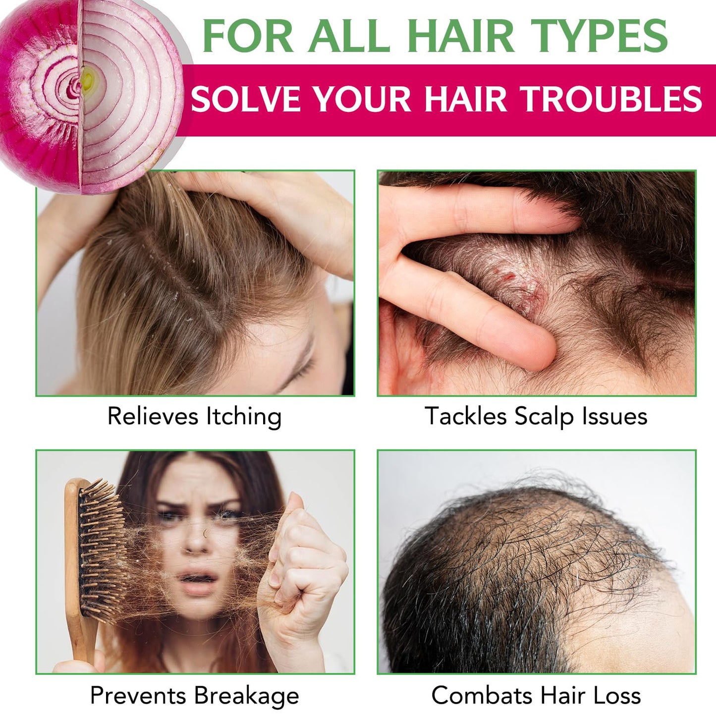 FSLHCY Onion Biotin and Rosemary Shampoo and Treatment Set, All Hair Types Conditioner Hair Care, Thinning Hair, Reduce Hair Loss -Soft and Shine