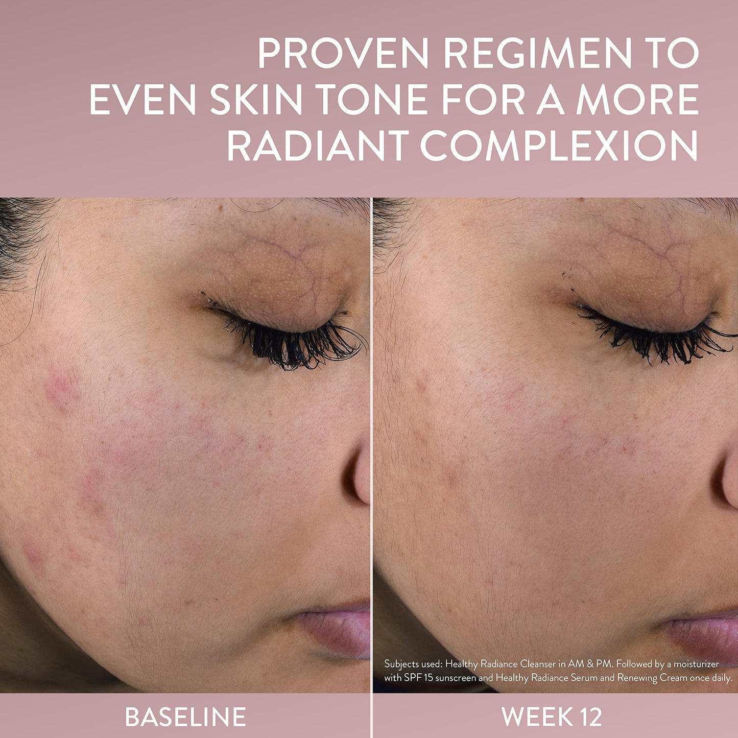 Cetaphil Face Serum, Healthy Radiance Antioxidant-C Serum, Visibly Reduces Look of Dark Spots and Hyperpigmentation, Designed for Sensitive Skin