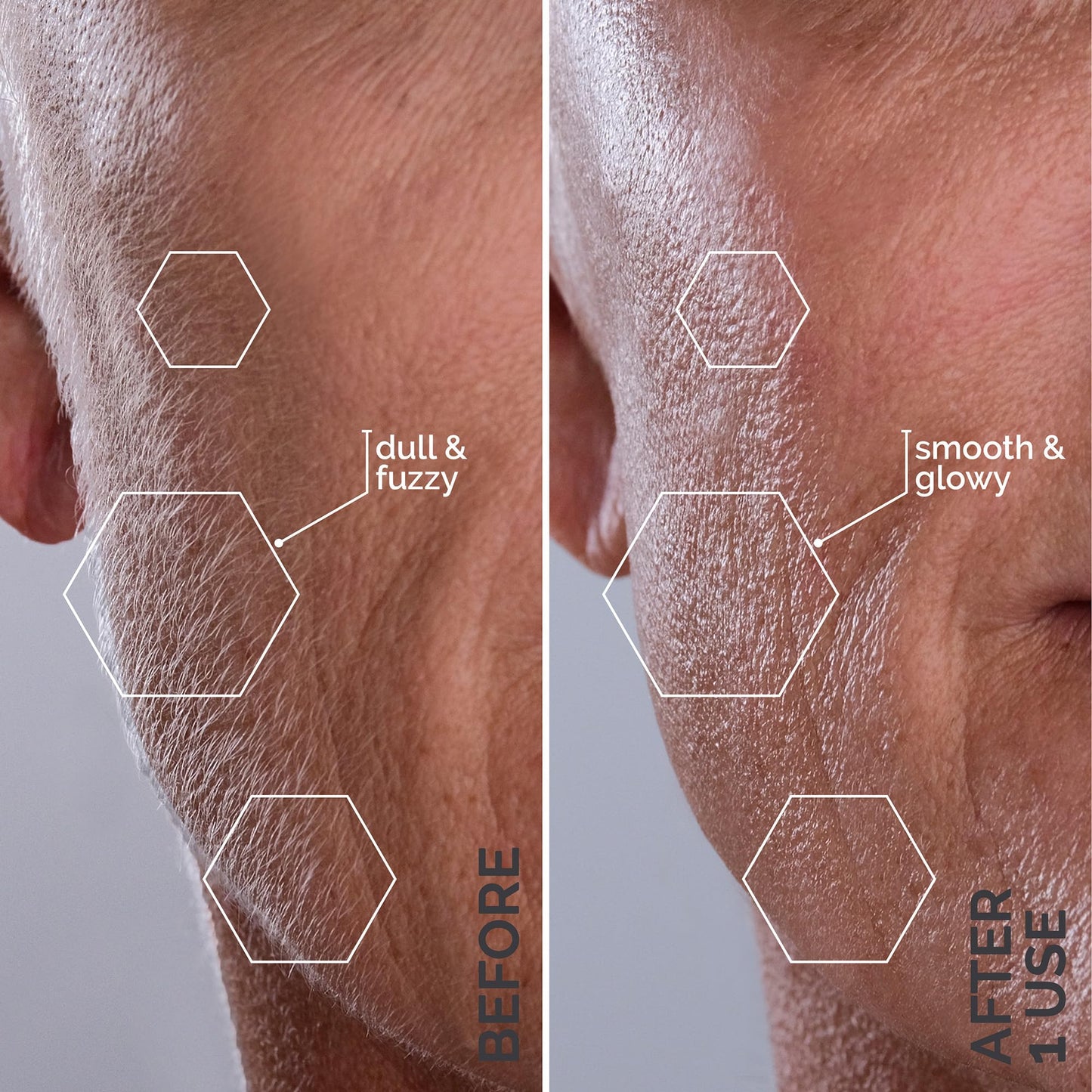 Michael Todd Beauty Sonicsmooth – Sonic Dermaplaning Tool for Women, 2-in-1 Facial Exfoliation & Peach Fuzz Remover with 8 Weeks Blades