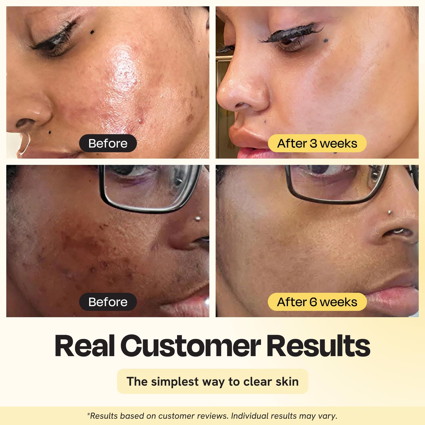Gleamin Vitamin C Clay Mask for Dark Spots, Turmeric Clay Face Mask Skin Care, Deeply Cleanses & Refines Pores, Brightens Uneven Tone and Helps