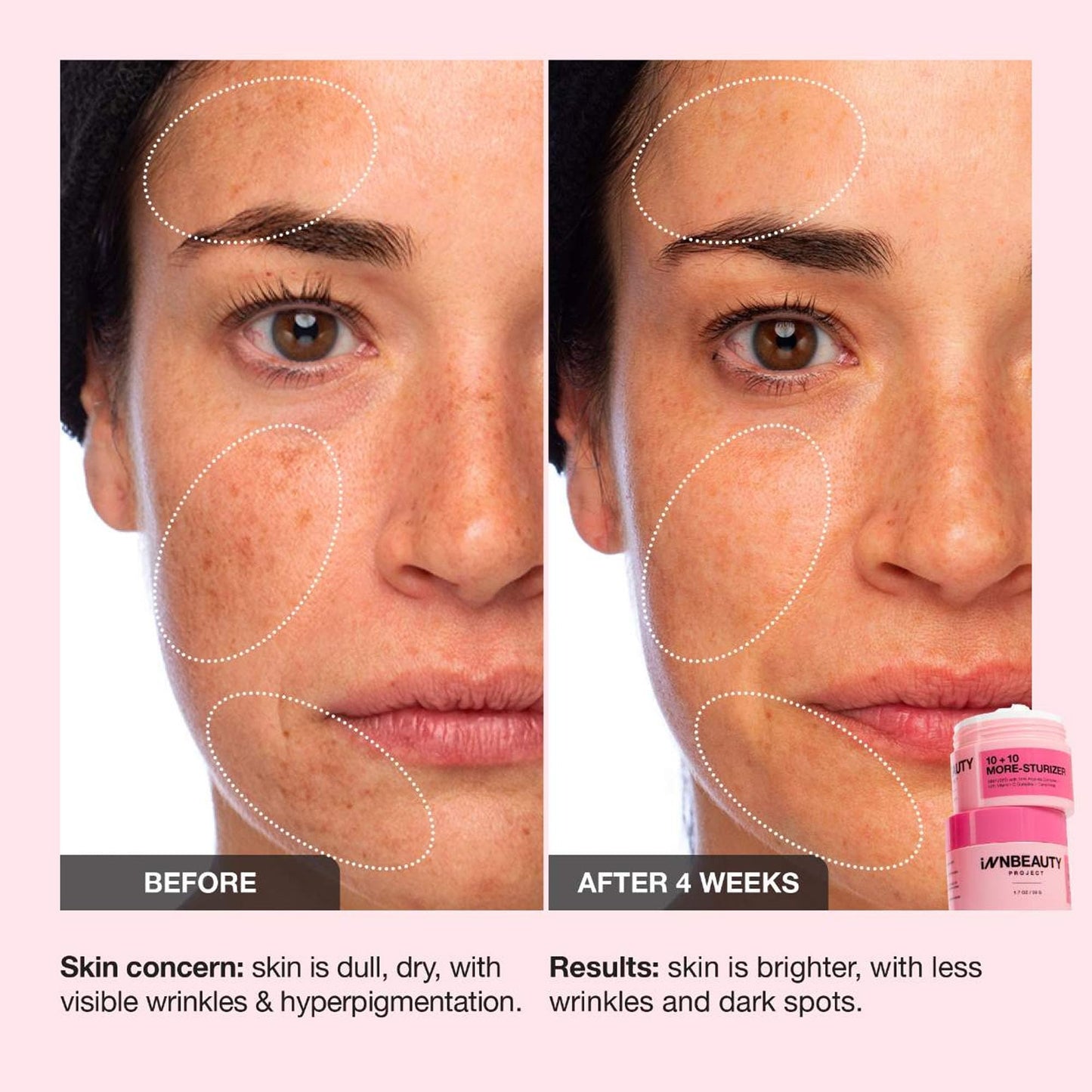 Innbeauty Project 10+10 Daily Moisturizer with 10% Vitamin C + 10% Peptide Complex + Ceramides, 1.7 OZ (50ml)