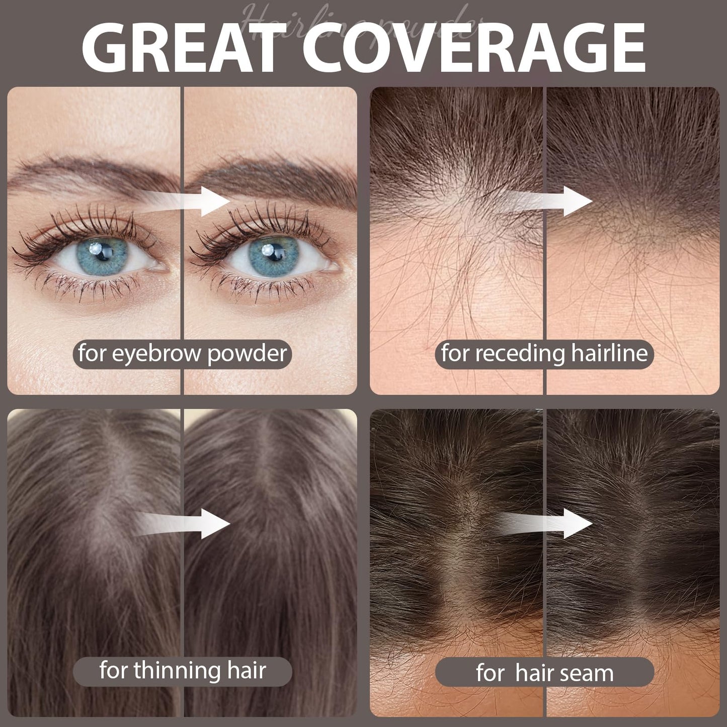 2 Pack Hairline Powder for Women and Men, Used to Root Touch Up Hair Color, Thinning and Gray Hair Coverage and Bald Spots Coverage, Dark Brown Beauty and Personal Care Comdian