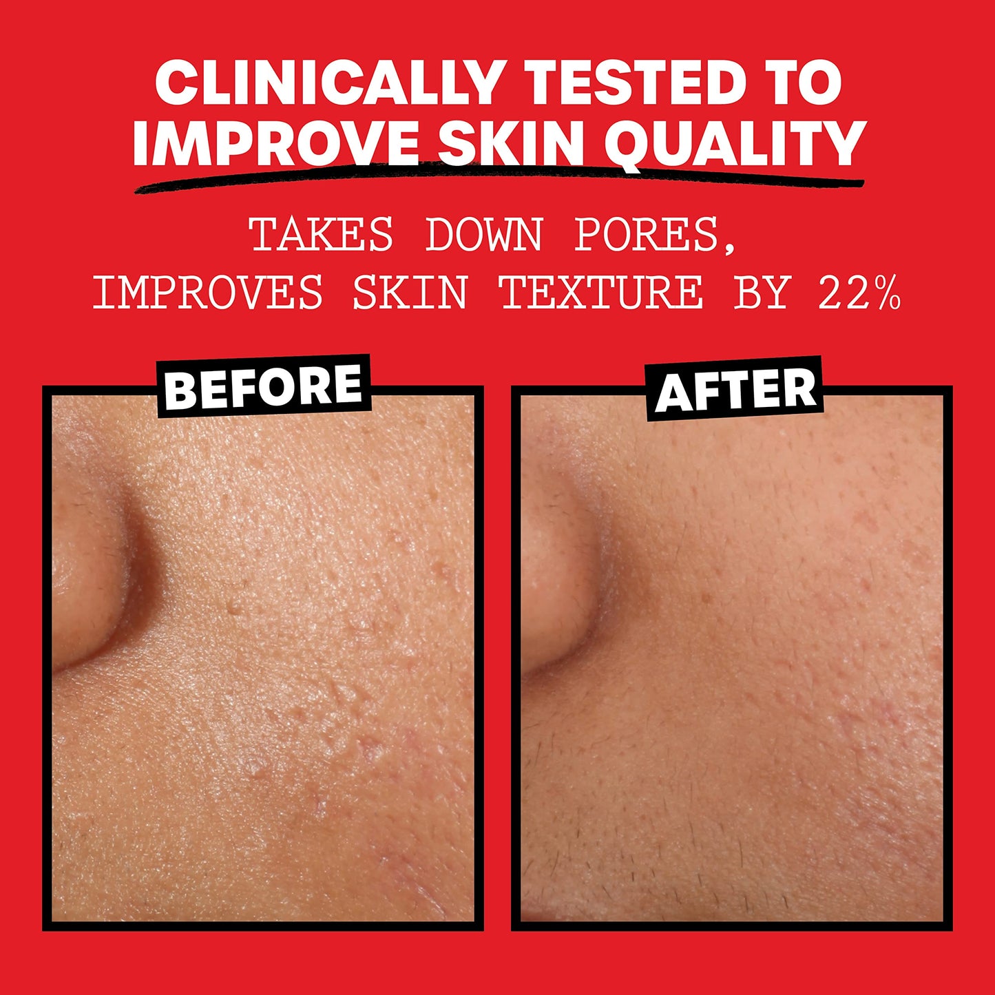 THAYERS Alcohol-Free, Hydrating Rose Petal Witch Hazel Facial Toner with Aloe Vera Formula, Vegan, Dermatologist Tested and Recommended, 12 Oz (Pack