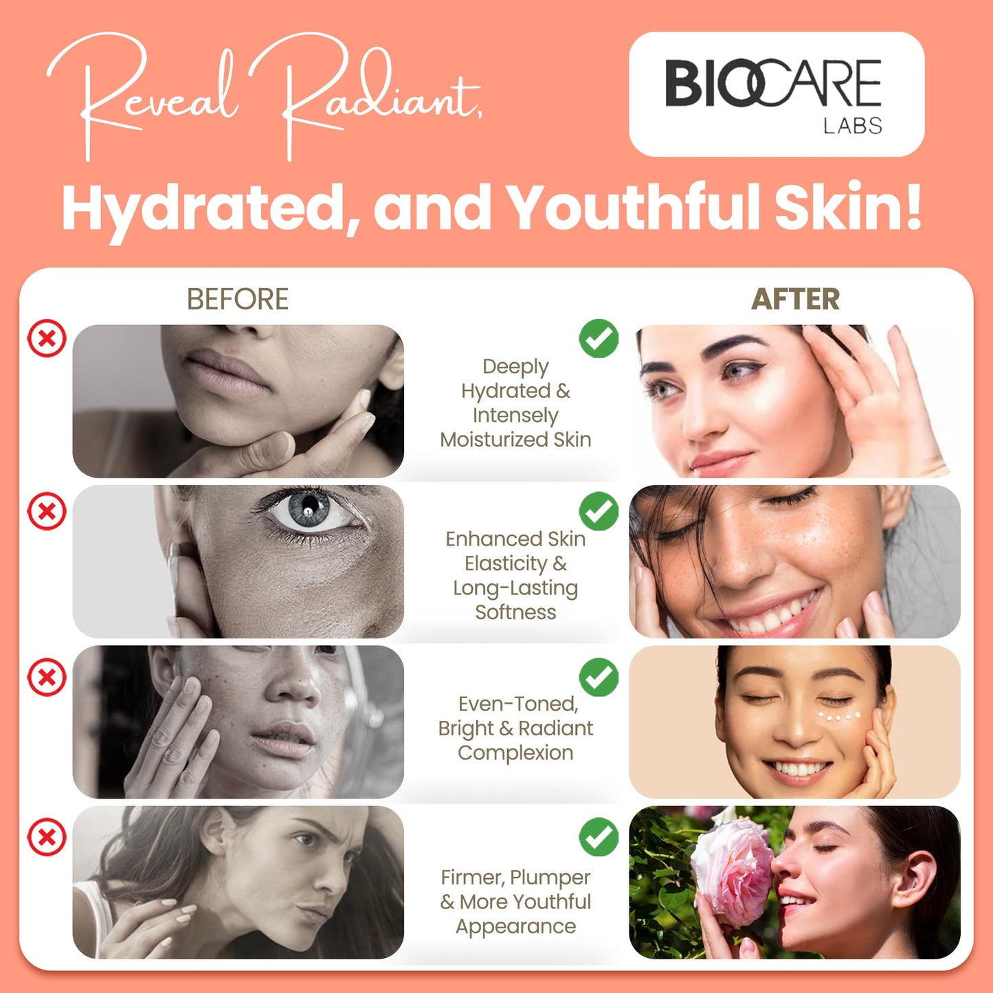 Biocare Body Butter - Infused with Cocoa Butter & Shea Butter plus Alpha-Bioplex for Youthful-Looking, Radiant Complexion, Hydrated, Smoother, Firmer