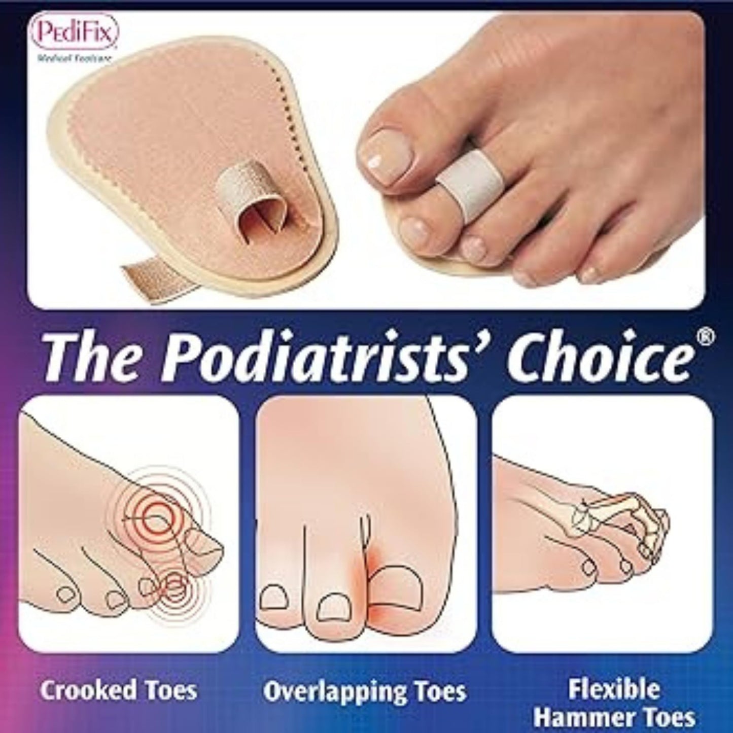 Pedifix Toe Straightener #P55 Beauty & Personal Care Pedifix