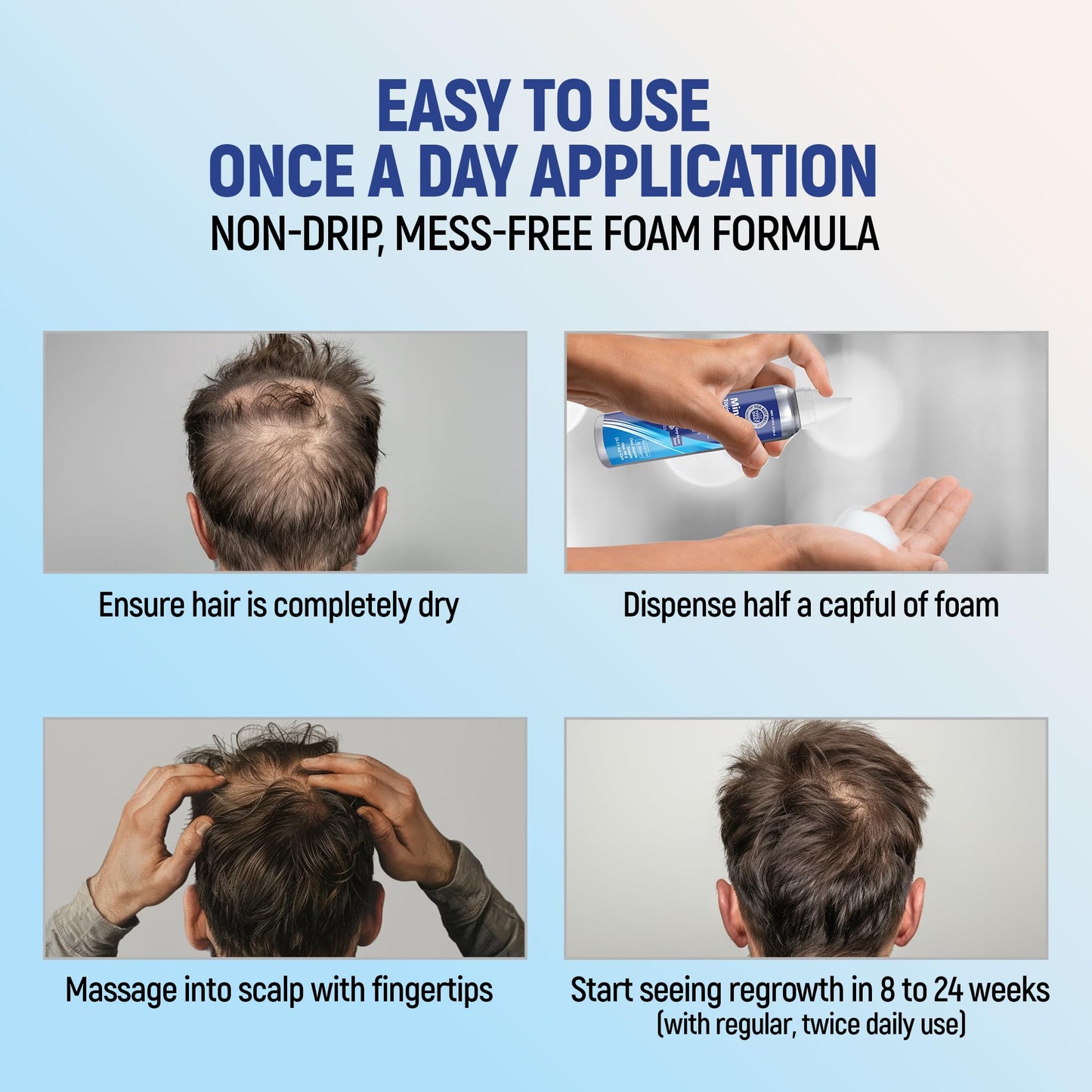 Minoxidil 5% Topical Aerosol Foam, Hair Regrowth 4 Months Treatment for Men, 2.11 oz (4 Pack) Beauty and Personal Care TARO
