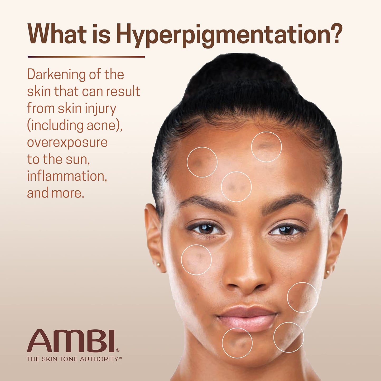 Ambi Even & Clear Advanced Fade Cream, Hydroquinone-free, Hyperpigmentation Treatment, Stubborn Dark Spot Corrector