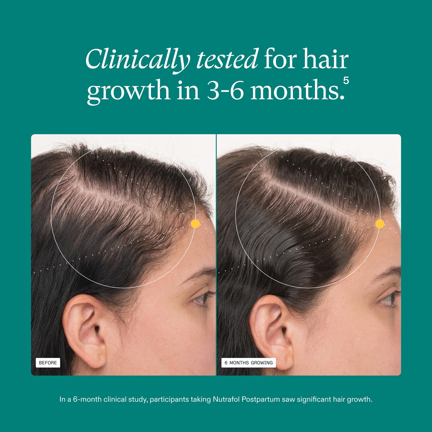Nutrafol Postpartum Hair Growth Supplements, Clinically Tested for Visibly Thicker Hair and Less Shedding, Breastfeeding-friendly - 2 Month Supply Beauty and Personal Care Nutrafol
