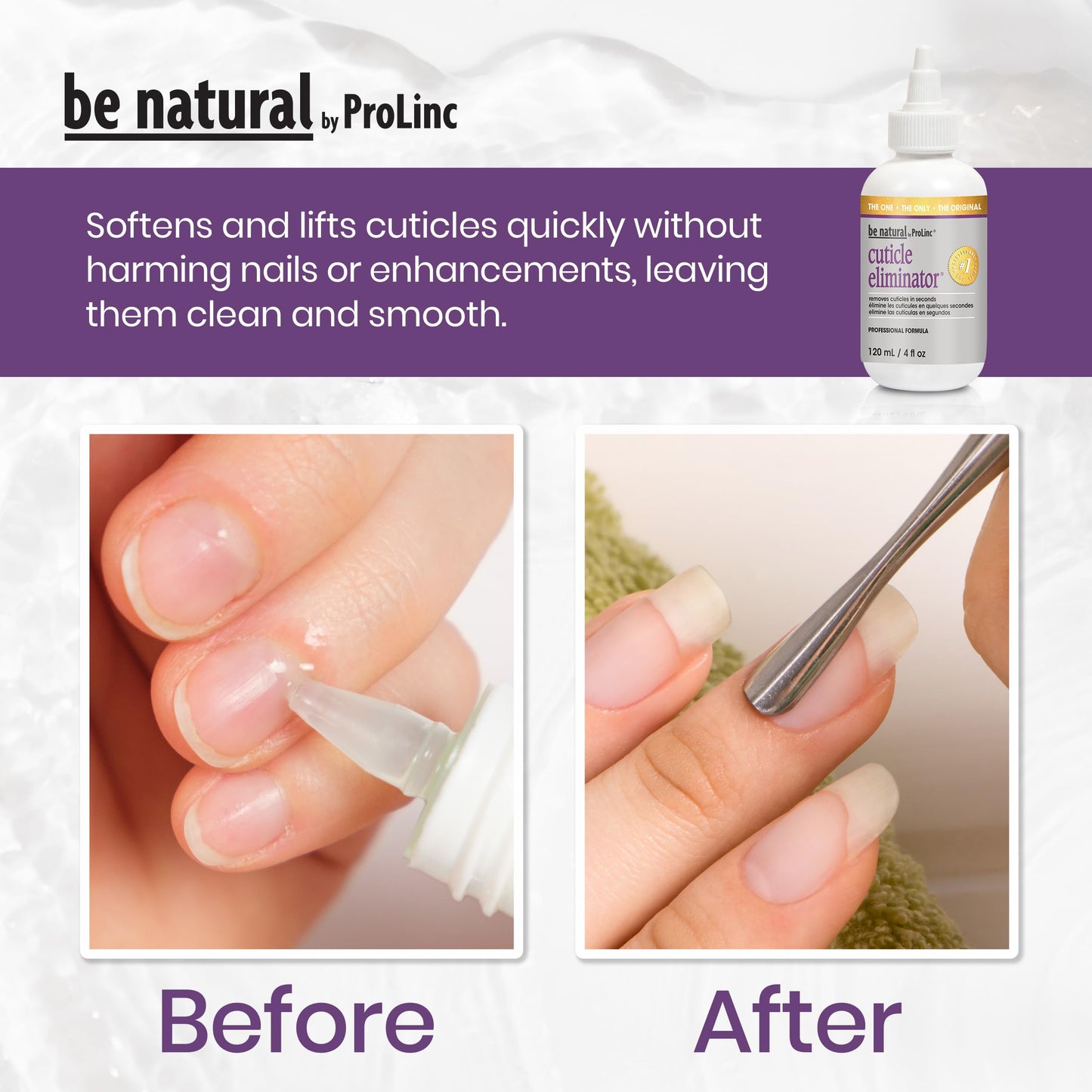 ProLinc Cuticle Eliminator - Instant Cuticle Remover Liquid, Softener for Nails, Removes Cuticles in Seconds, Nail Care, 2 fl oz