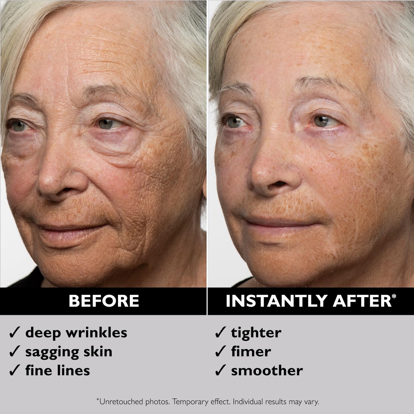 Peter Thomas Roth | Instant FIRMx Temporary Face Tightener