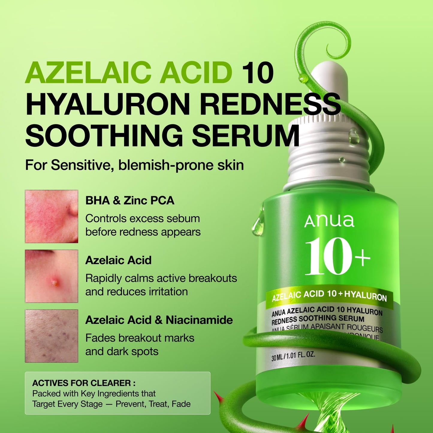 Anua Azelaic Acid 10 Hyaluron Redness Soothing Serum, Facial Serum for Blemish-Prone & Oily-Prone Skin, Lightweight & Hydrating Blemish Care Beauty and Personal Care ANUA