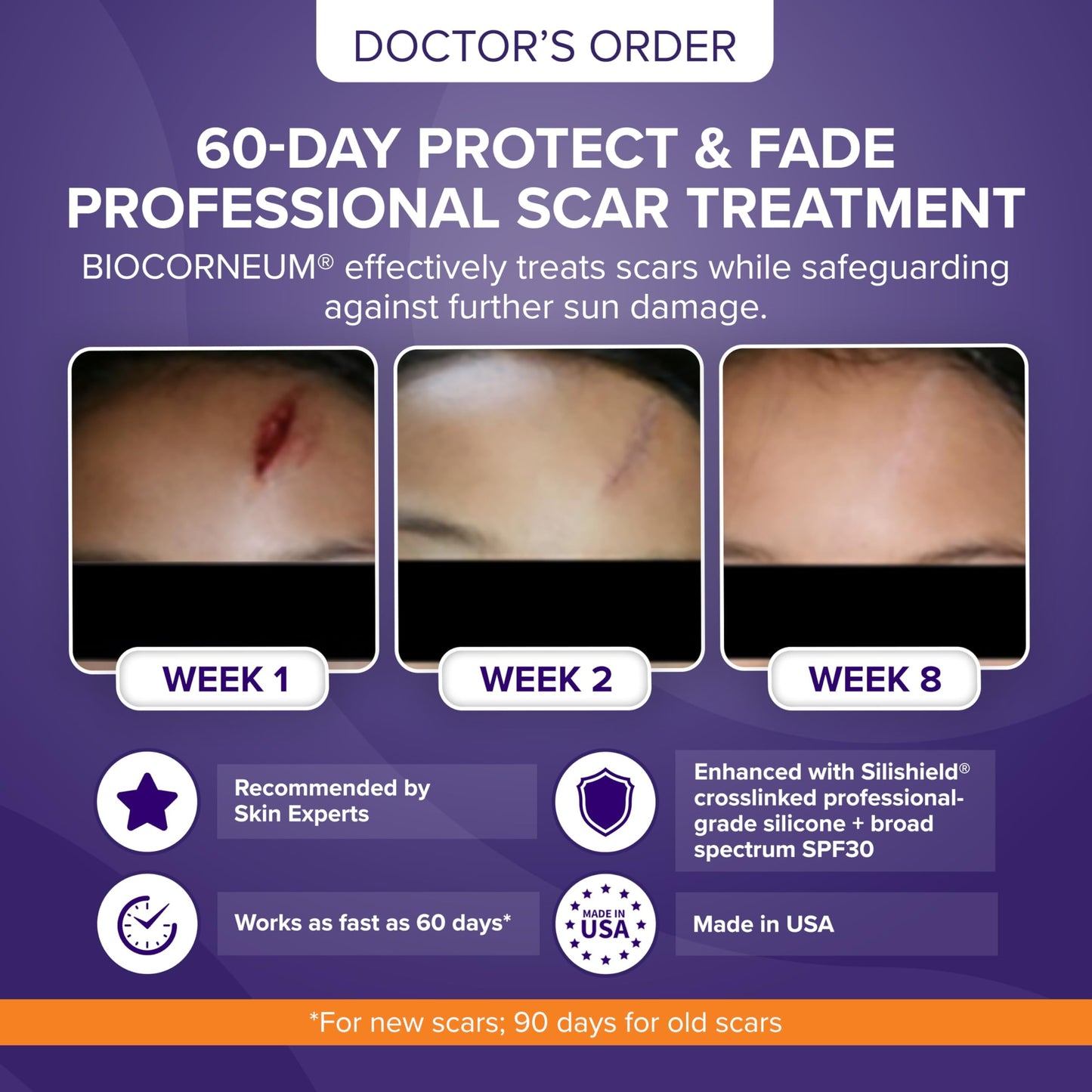 Biocorneum Silicone Scar Gel with Silishield®, SPF 30 Scar Cream, 20g Beauty and Personal Care BIOCORNEUM