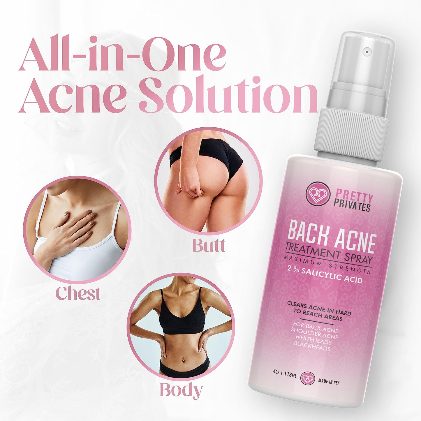 Pretty Privates Premium Back Acne Spray - Body, Butt and Back Acne Treatment Spray - with 2% Salicylic Acid - Bacne Scar and Spot Clearing Solution