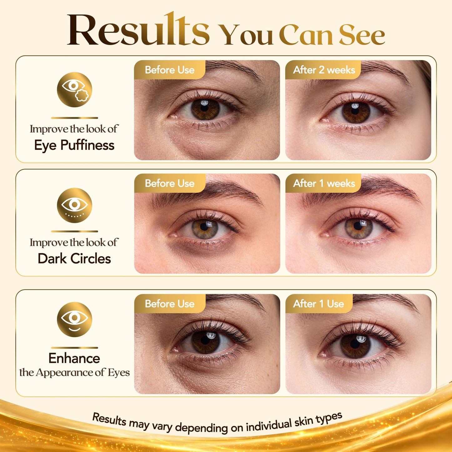 FENGOO 80 PCS 24K Gold Collagen Under Eye Patches & Smile Line Patches Beauty and Personal Care FENGOO