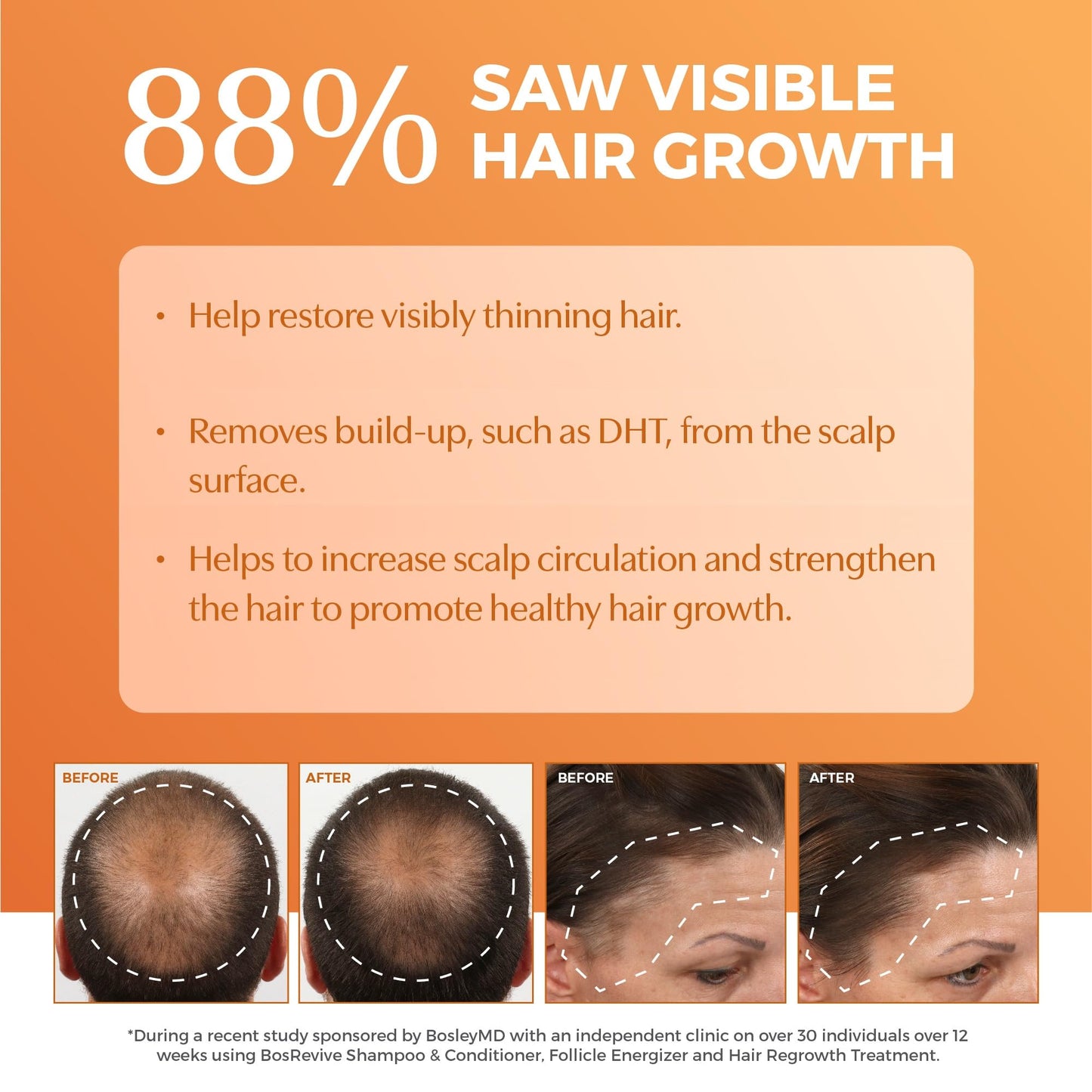 BosRevive Volumizing Conditioner for Thinning, Color/Chemically-Treated Hair - DHT Blocker, Sulfate-Free, Vegan, Biotin, Saw Palmetto & Rosemary