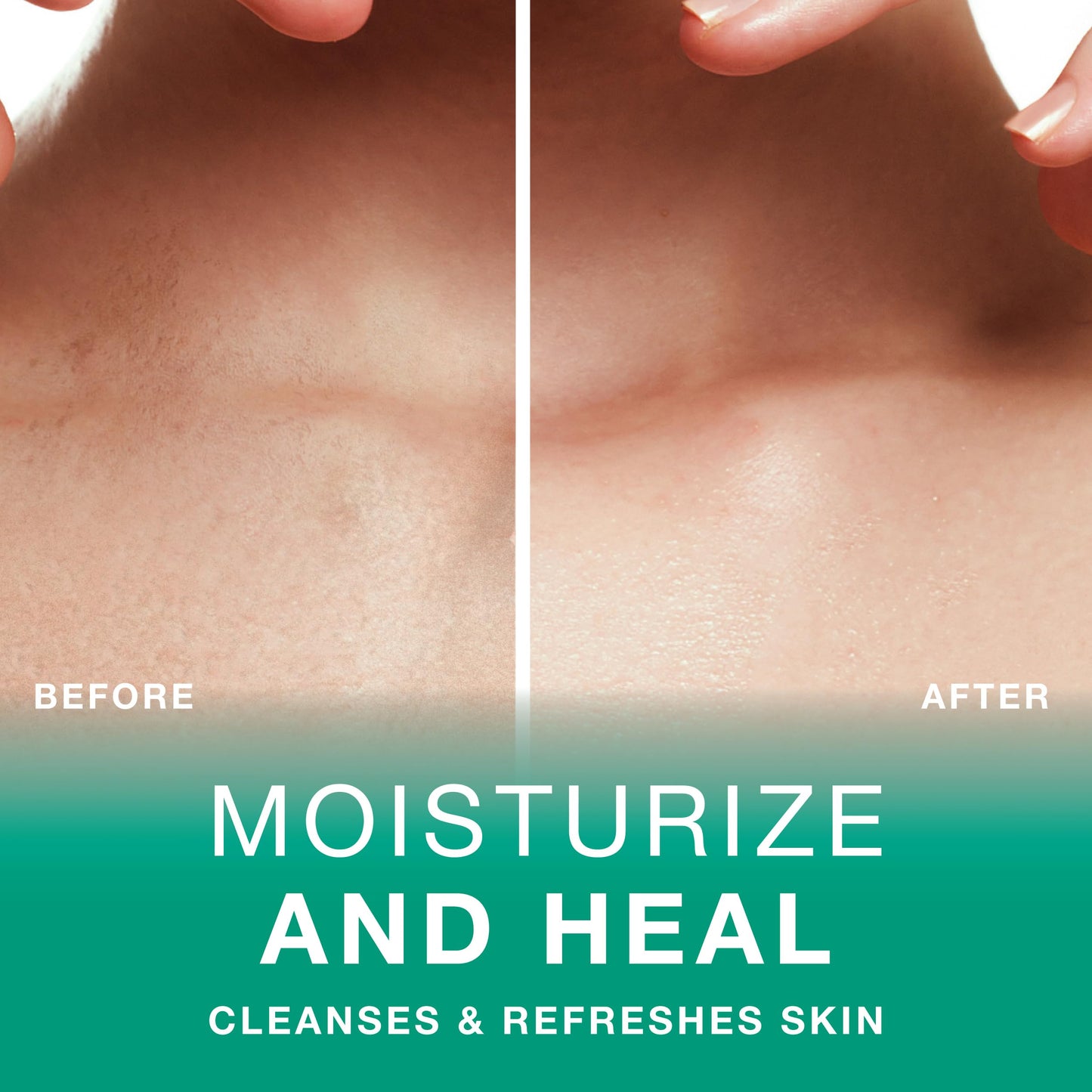 Moisturizing & Healing Body Wash with Sea Kelp & Aloe Vera - Hydrating Cleanser for Dry Skin - Vitamin-Enriched Shower Gel - 33.8 fl oz