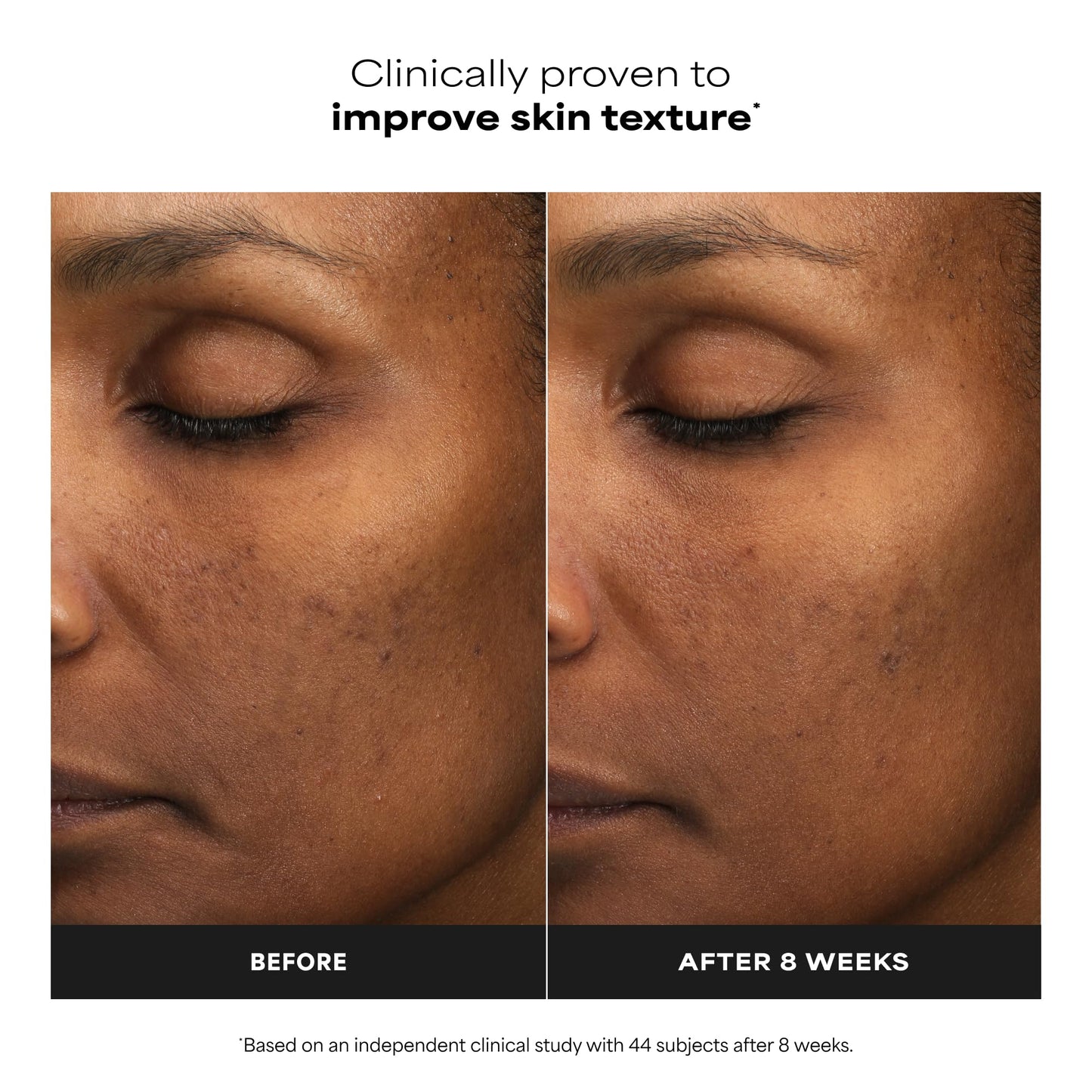 Paula’s Choice 6% Mandelic Acid + 2% Lactic Acid Exfoliant, Gentle Daily AHA Exfoliation for Discoloration, Bumpy Texture & Radiance, for Sensitive Beauty and Personal Care Paula's Choice