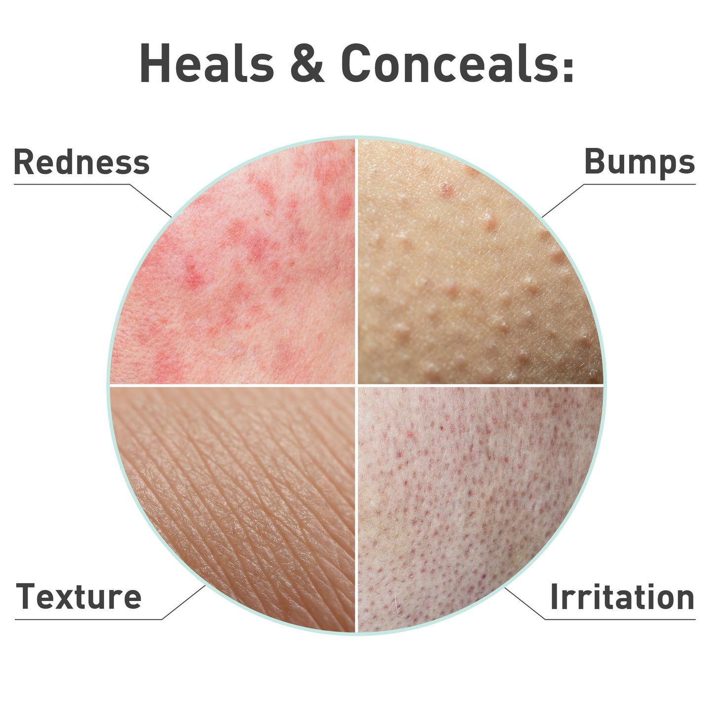 Procure Rosacare Serum 1.08 fl oz