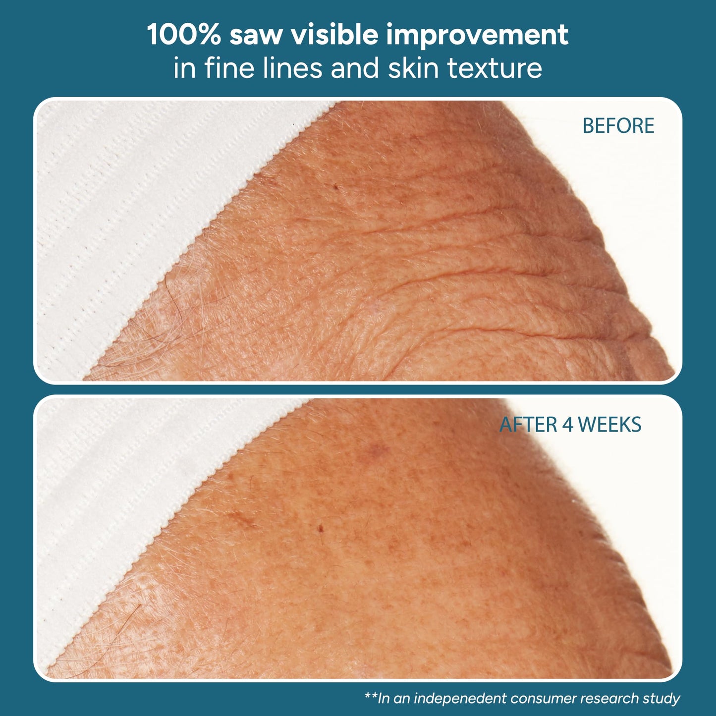 Lancer Skincare | The Method: Nourish Face Moisturizer | Anti Aging Face Cream with Hyaluronic Acid | Lightweight Daily Moisturizer for Oily Congested