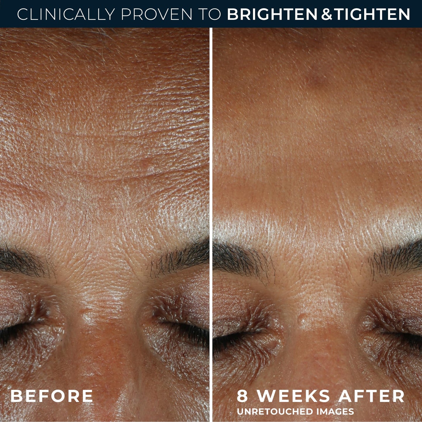 RoC Multi Correxion Revive + Glow 10% Active Vitamin C Serum for Face, Daily Anti-Aging Wrinkle and Skin Tone Skin Care Treatment, Brightening Serum