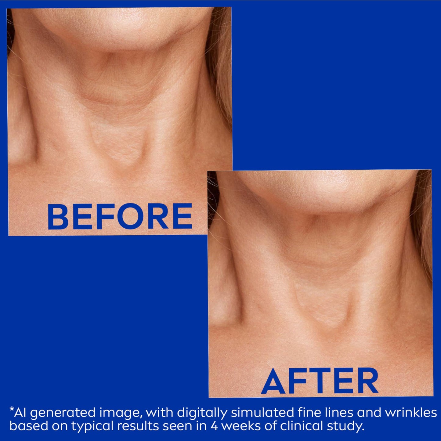 NIVEA Neck & Chest Firming Anti Wrinkle Cream with Q10, 6.7 Oz Beauty and Personal Care NIVEA