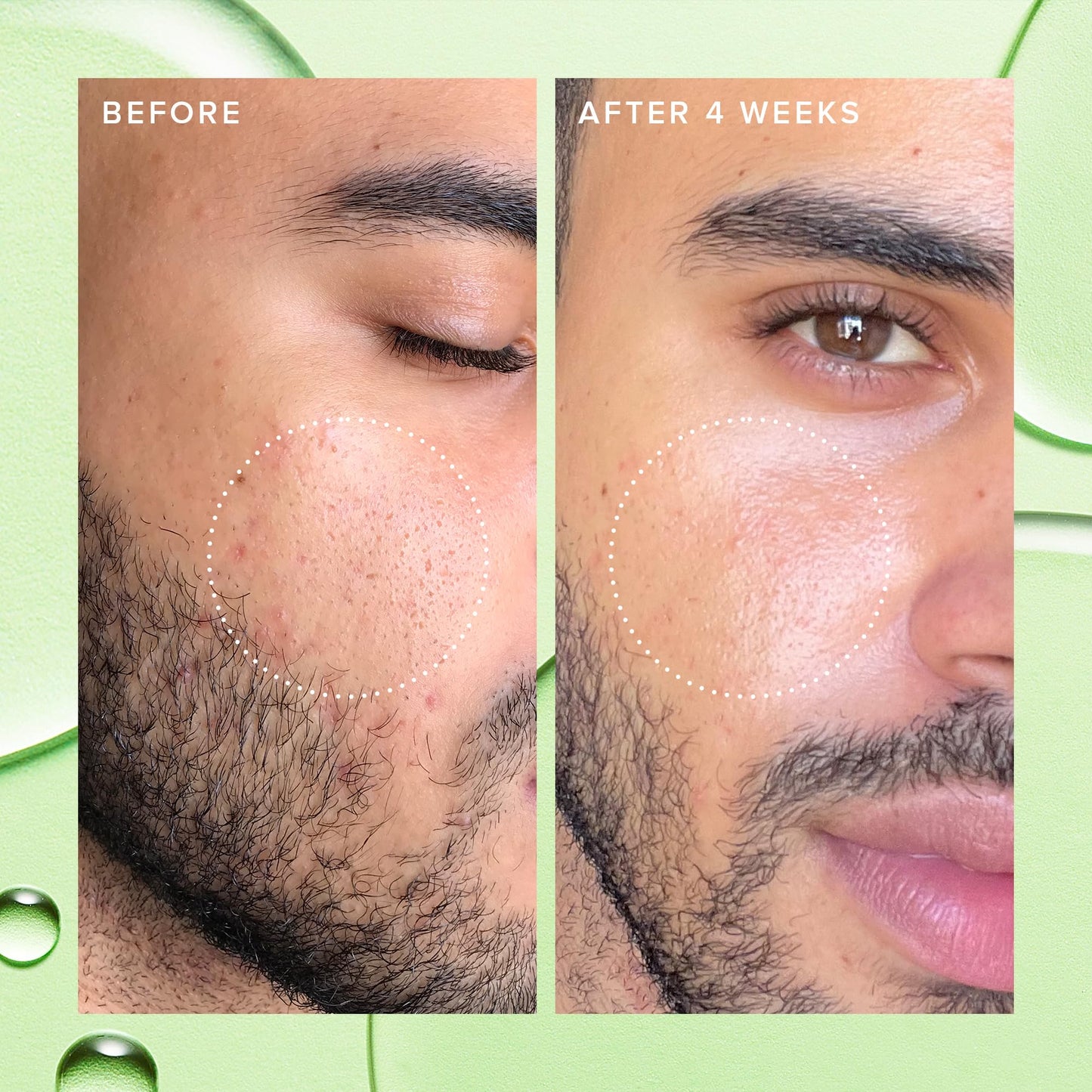 Farmacy 2% Salicylic Acid Toner for Face - Deep Sweep Gentle BHA Exfoliant for Oily Skin - Refines Texture with Papaya Enzymes & Moringa Water for a