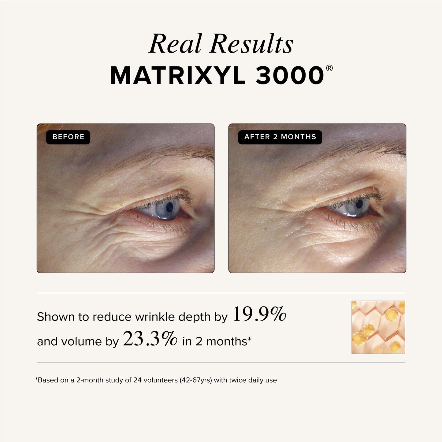Asterwood Triple Repair Matrixyl 3000 + Argireline + Hyaluronic Acid + Vitamin C Serum for Face - Anti-Aging, Collagen Boosting, Hydrating Beauty & Personal Care Asterwood