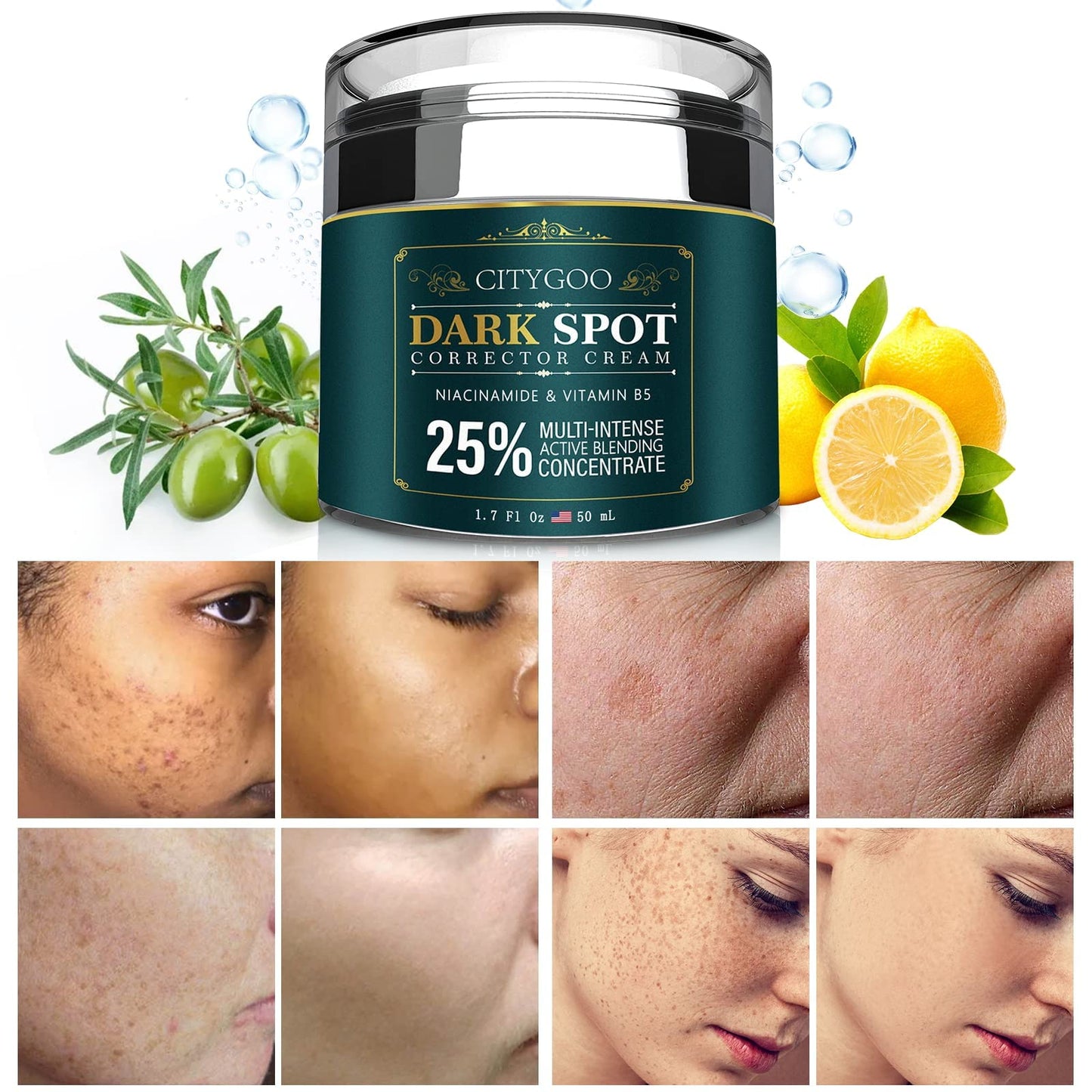 CITYGOO Dark Spot Remover for Face: Dark Spot Corrector Cream - Enriching Skin Care For All Skin Tones - Melasma Freckle Sun Spot Remover & Blemish