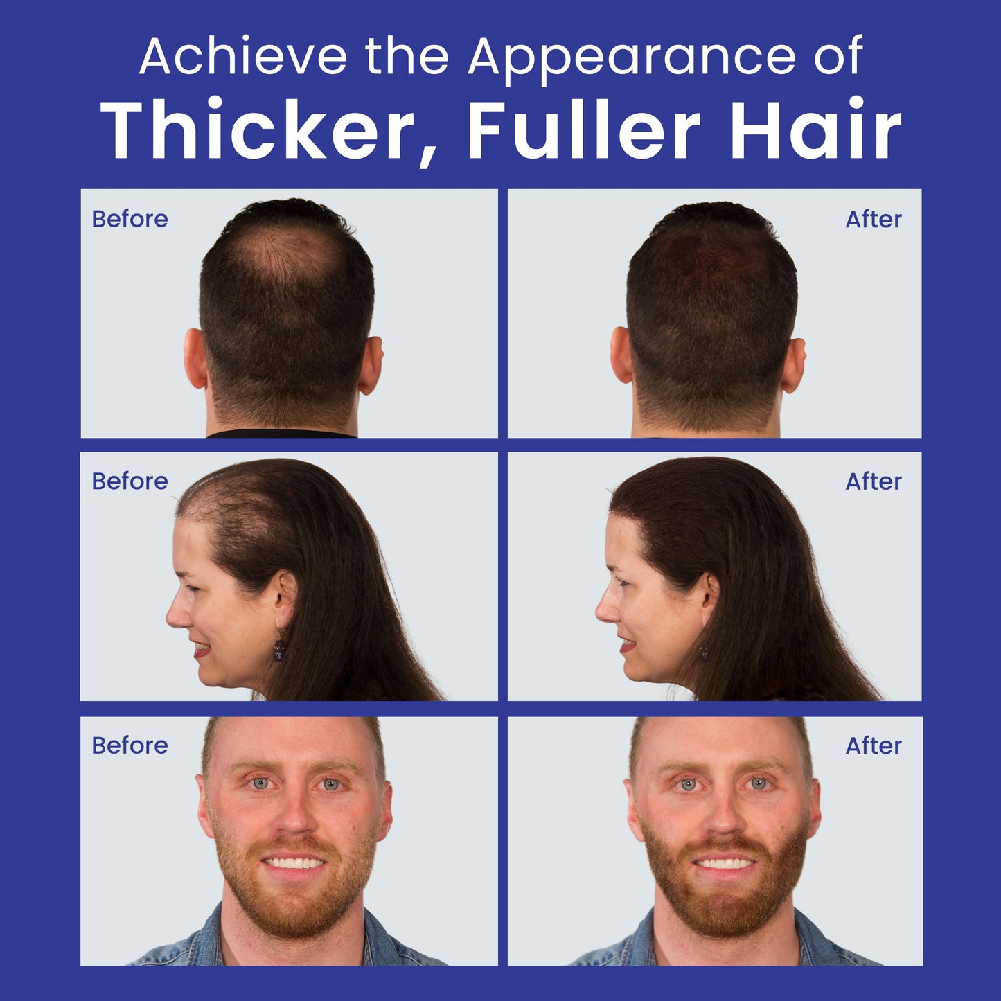 INFINITY Hair Fibers Medium Brown for Thinning Hair for Women & Men - 100% Undetectable Hair Building Fiber Powder - Conceal Hair Loss in 15 Seconds