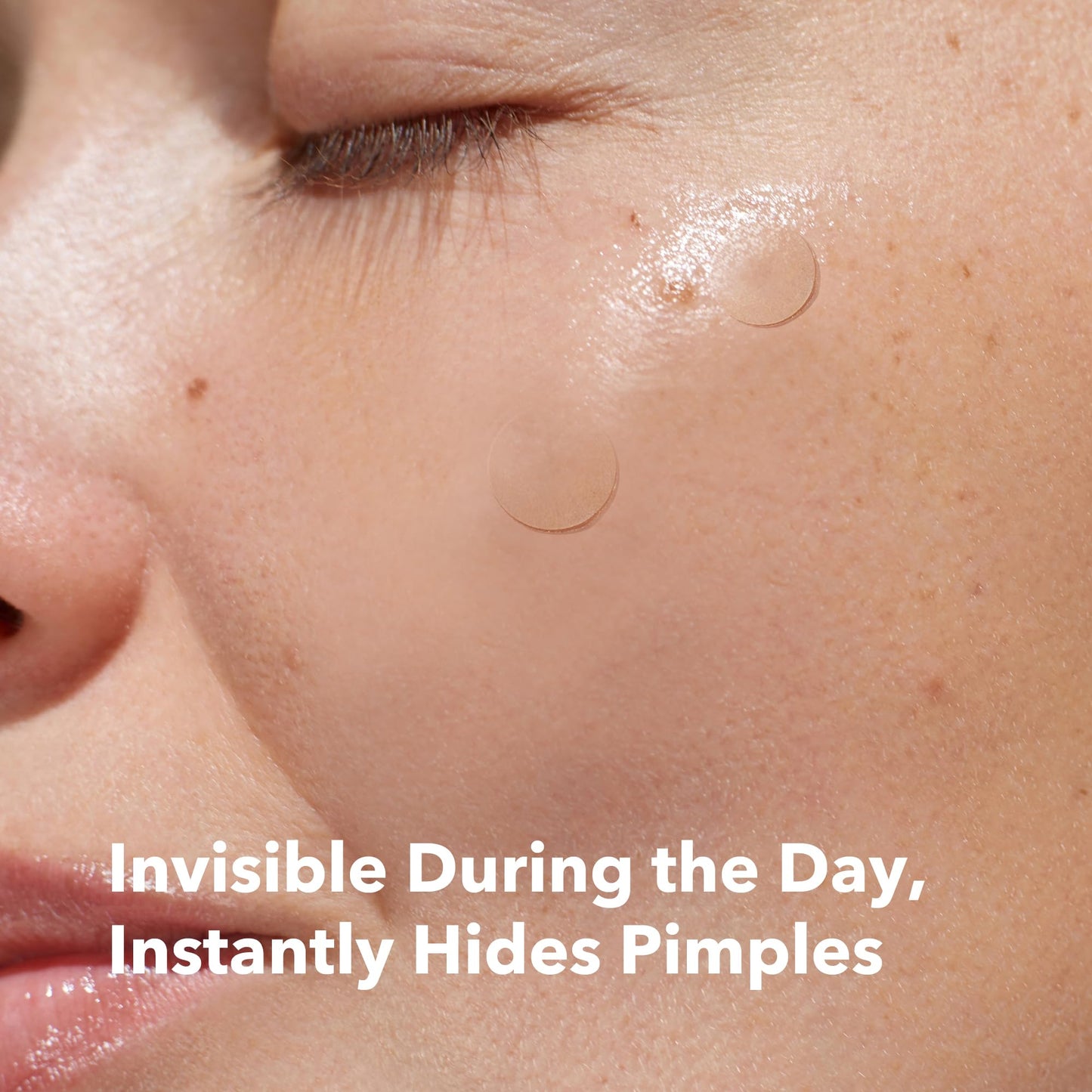 AVARELLE Invisible Acne Spot Patch (24 Count) Ultra Thin Hydrocolloid Spot Sticker for Day Time Acne l For Covering Zits & Blemish with Calendula