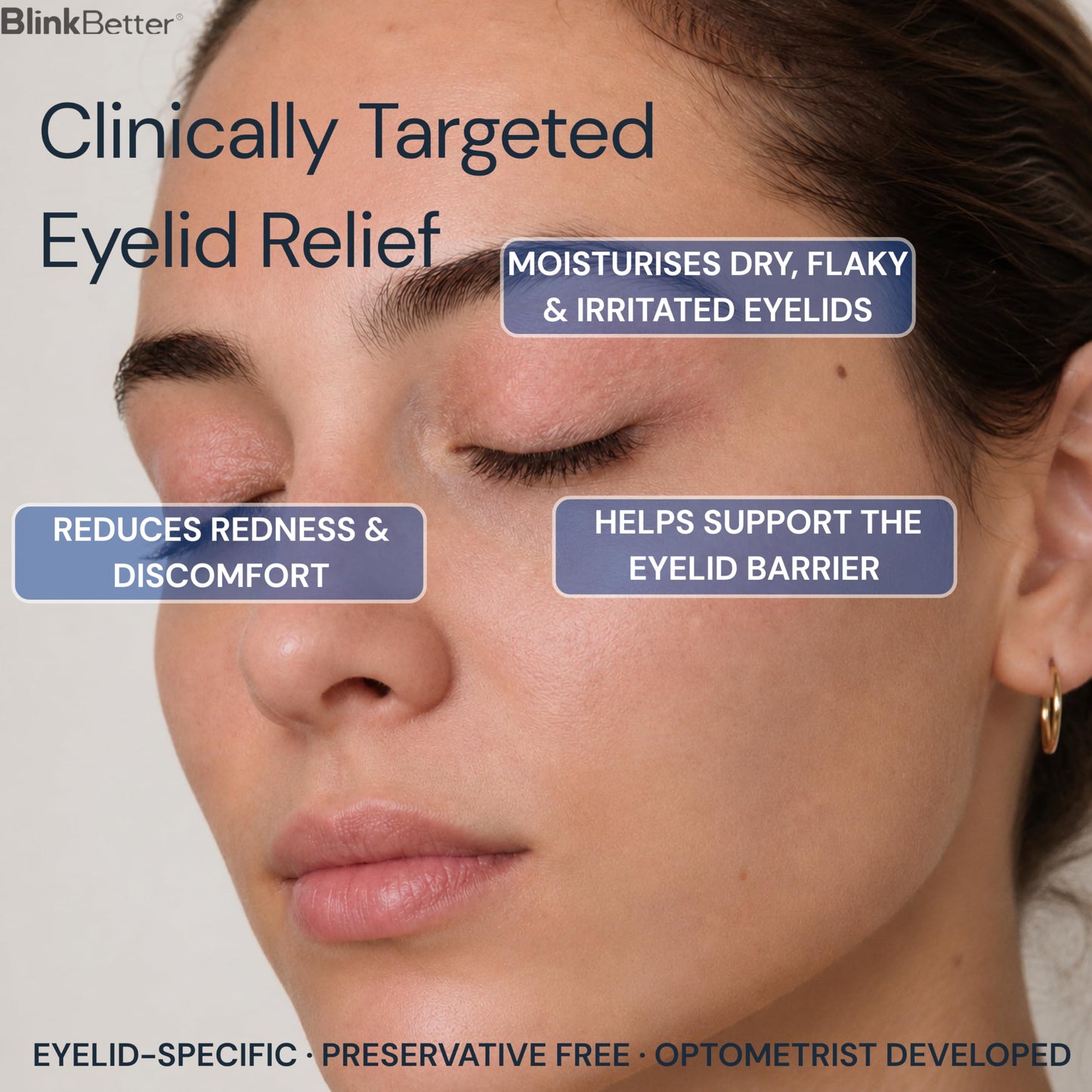 BlinkBetter BetterLids Eyelid Ointment for Dry, Itchy & Sensitive Eyelids - Deep-Moisturising Oat Complex with Shea Butter & Panthenol to Hydrate Beauty and Personal Care BlinkBetter