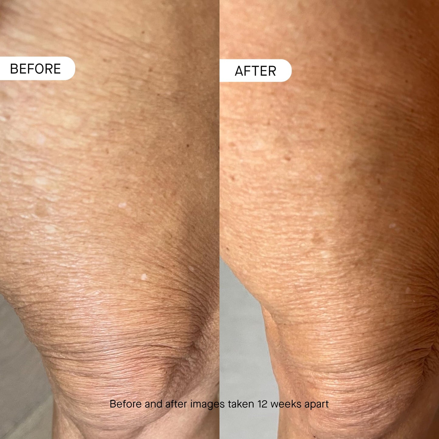 OneSkin OS-01 BODY Topical Supplement Moisturizer | Age Reversal, 8.45 Oz Beauty and Personal Care oneskin