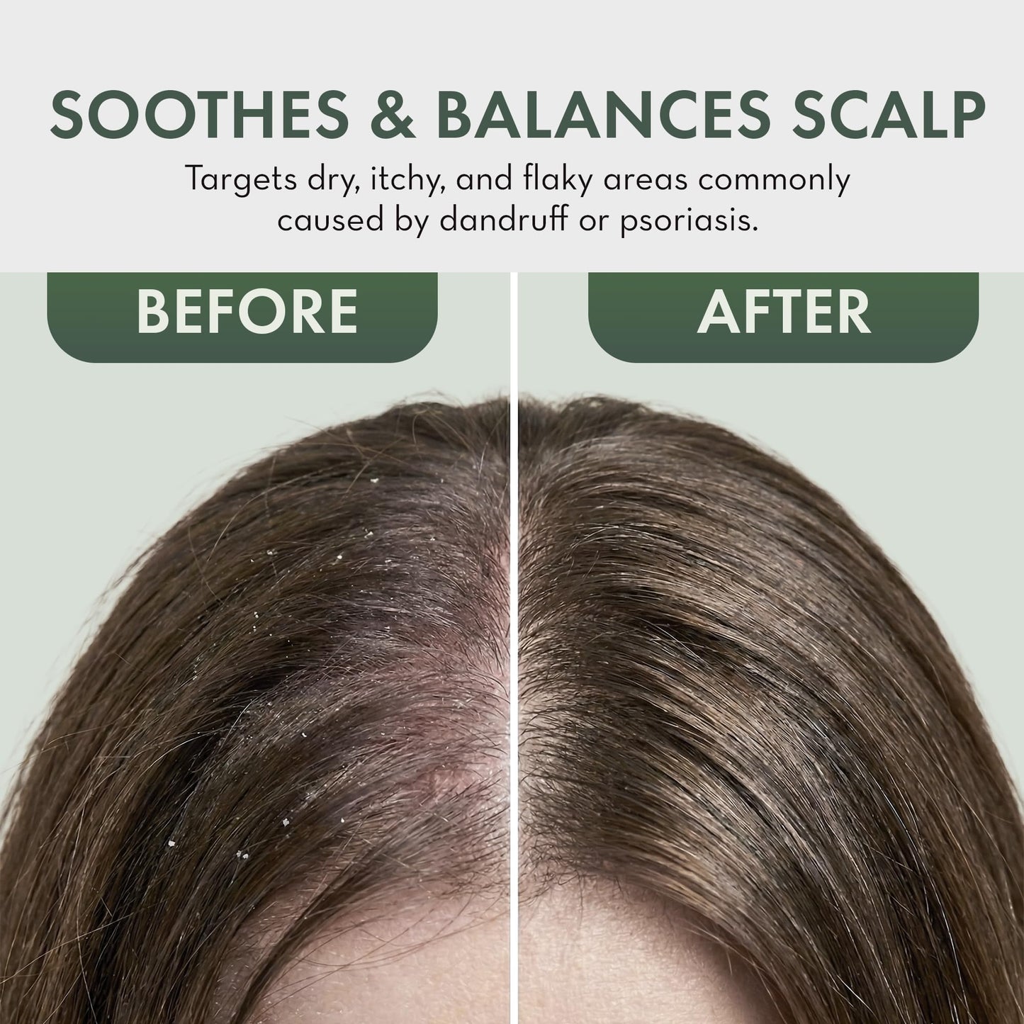 Leave In Conditioner Spray - Tea Tree Scalp Treatment Beauty and Personal Care PHARM TO TABLE