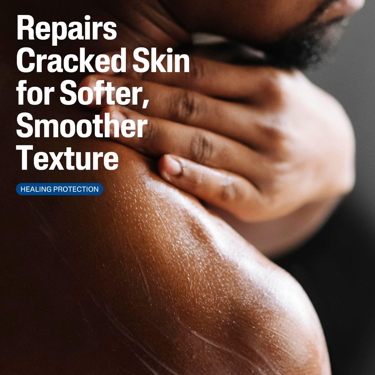 Cetaphil Cracked Skin Repair Lotion, 16 oz, For Very Rough & Cracked, Sensitive Skin, 24 Hour Hydration, Protects & Hydrates Cracked Skin