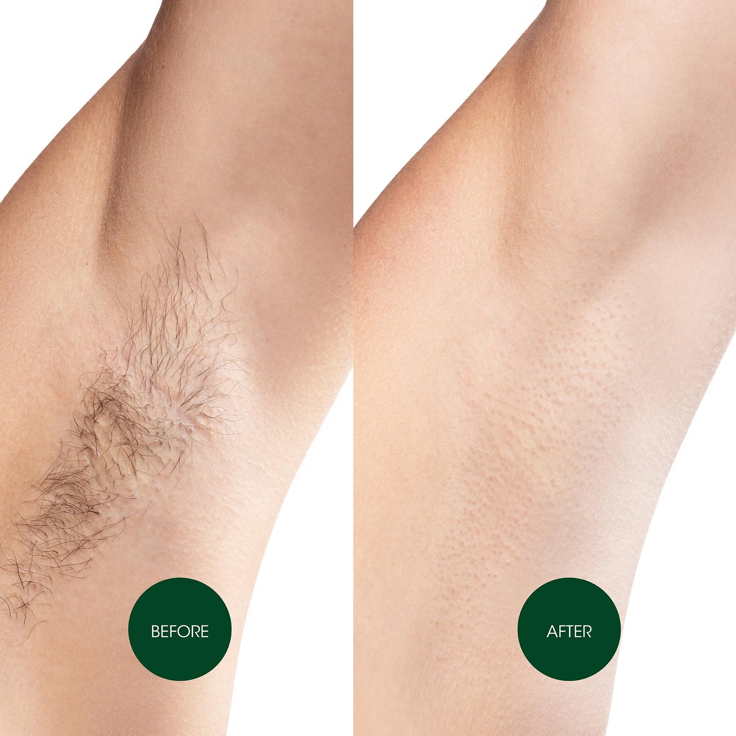 Nad's Body Wax Strips Hair Removal For Women All Skin Types, 20 Waxing Strips + 4 Calming Oil Wipes