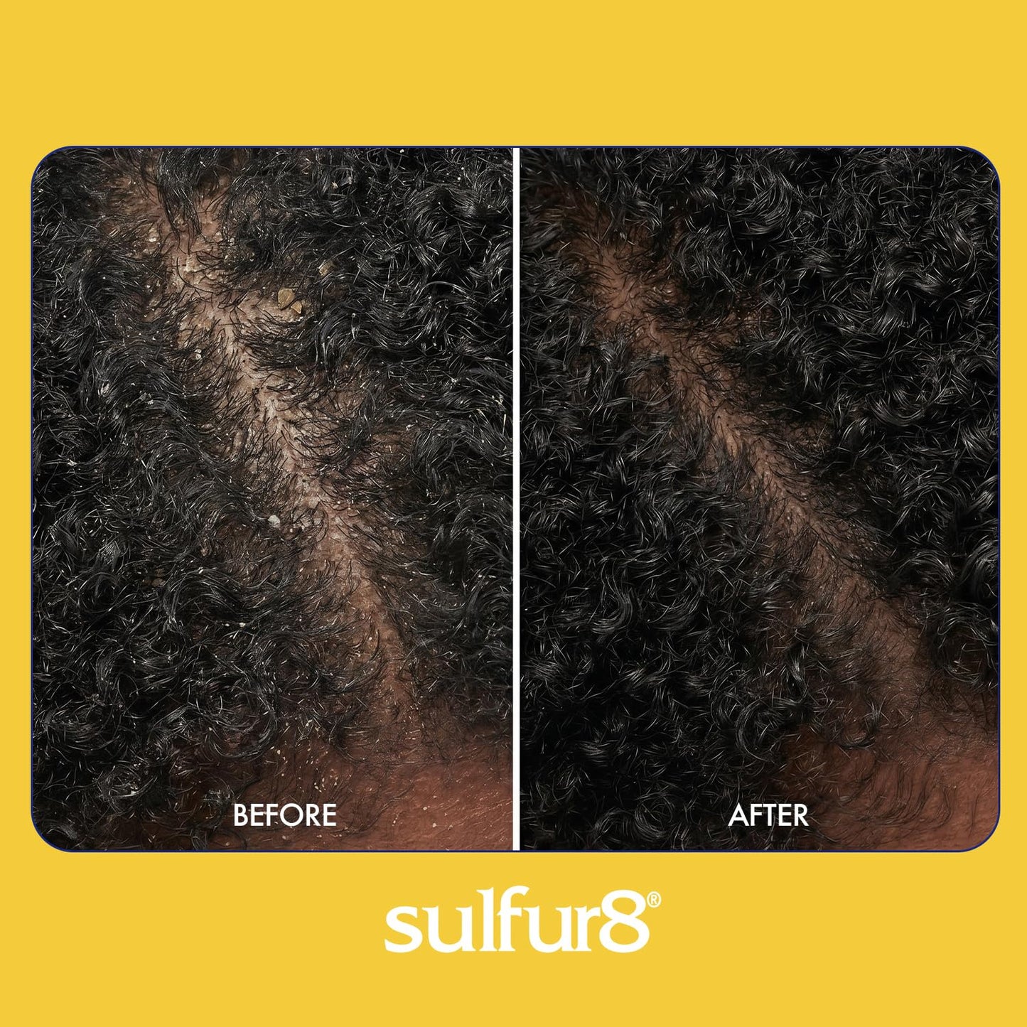 SULFUR8 Medicated Anti-Dandruff Hair & Scalp Conditioner 2 oz - Helps Control Dandruff, Soothes Itchy Scalp & Moisturizes Hair with Refreshing Clean Beauty and Personal Care SULFUR8