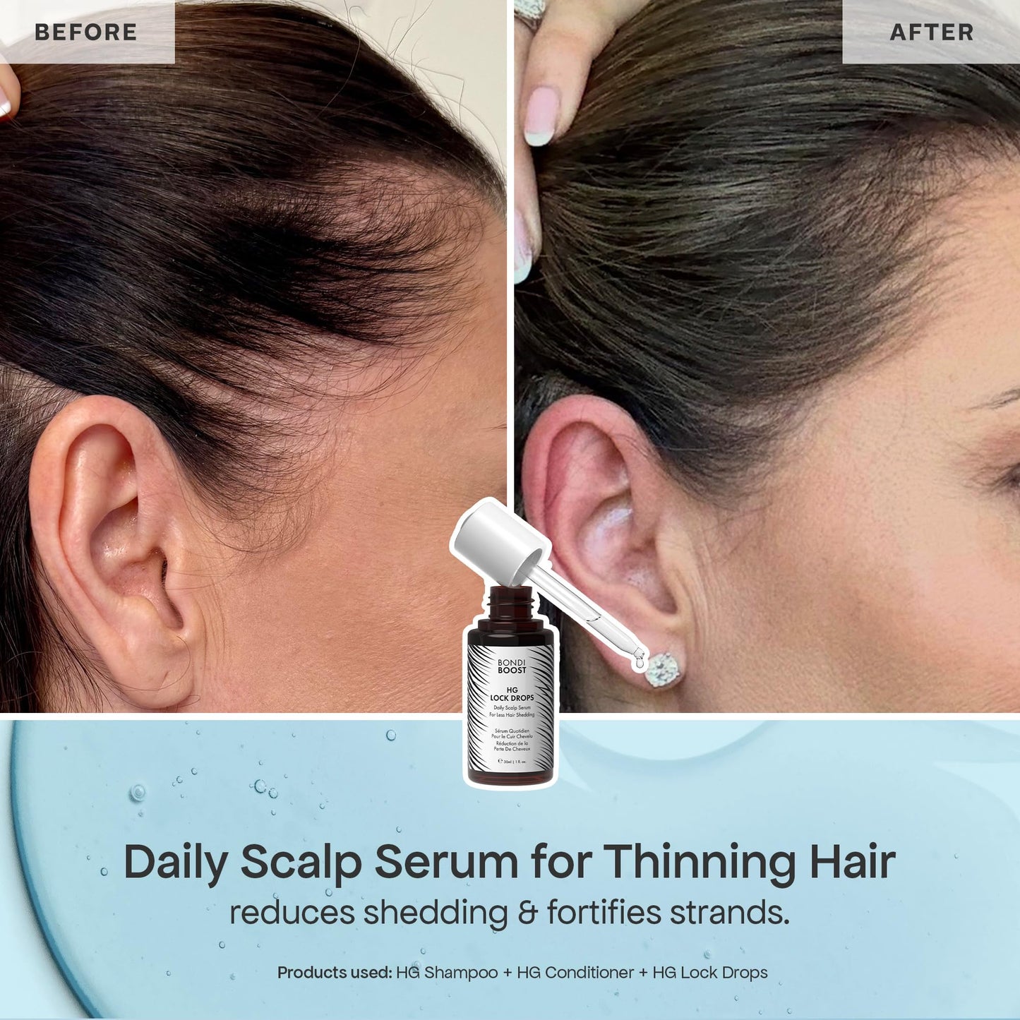 BondiBoost Shed Happens Anti-Thinning Hair Trio - HG Shampoo + Conditioner (90ML) + Lock Drops Serum (30ML) - Reduces Shedding, Supports Fuller
