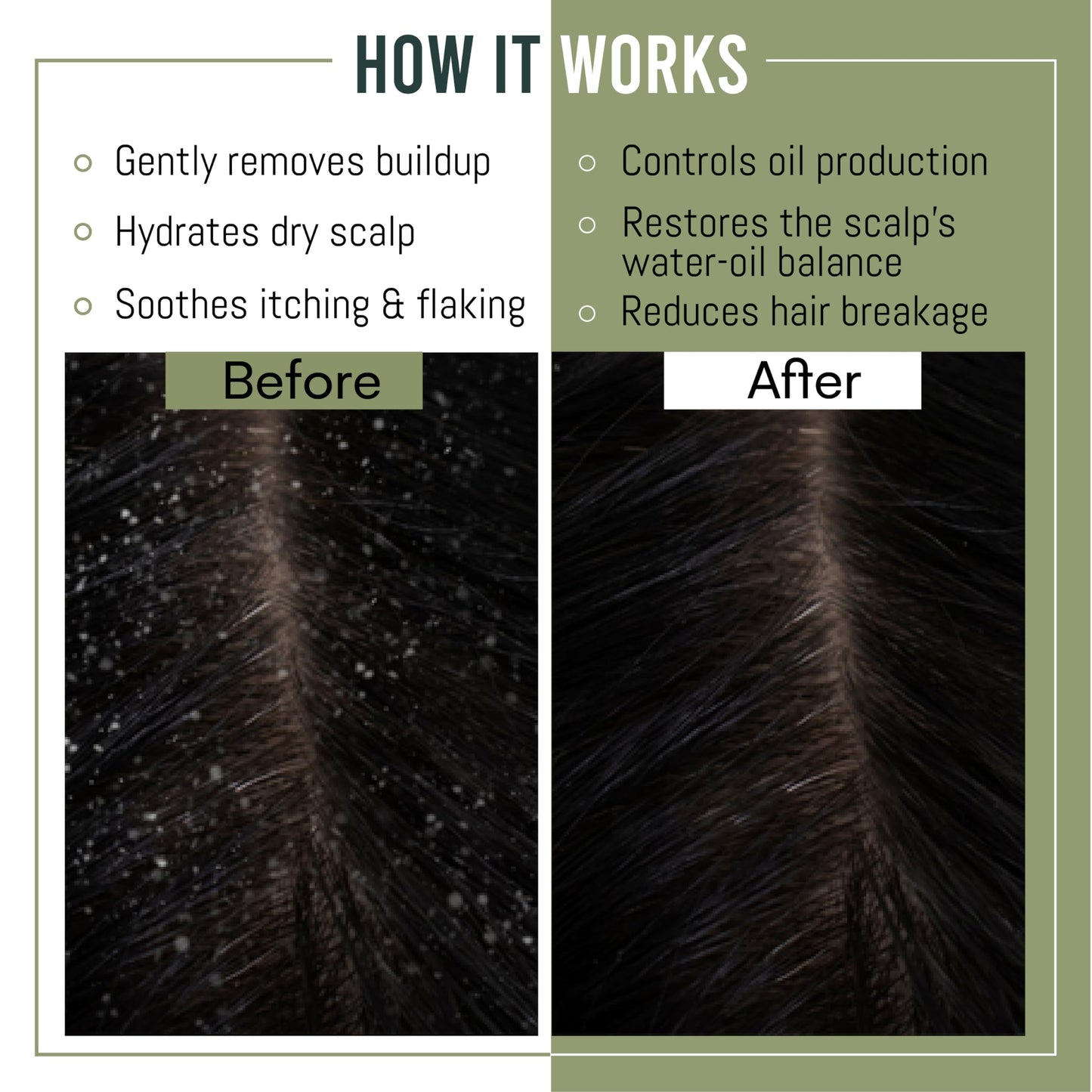 MagiForet Anti-dandruff & Scalp Treatment Shampoo 500ml For Dry, Flaky scalps, Help Clear Flakes, Leave Dry, Itchy Scalps Feeling Soothed