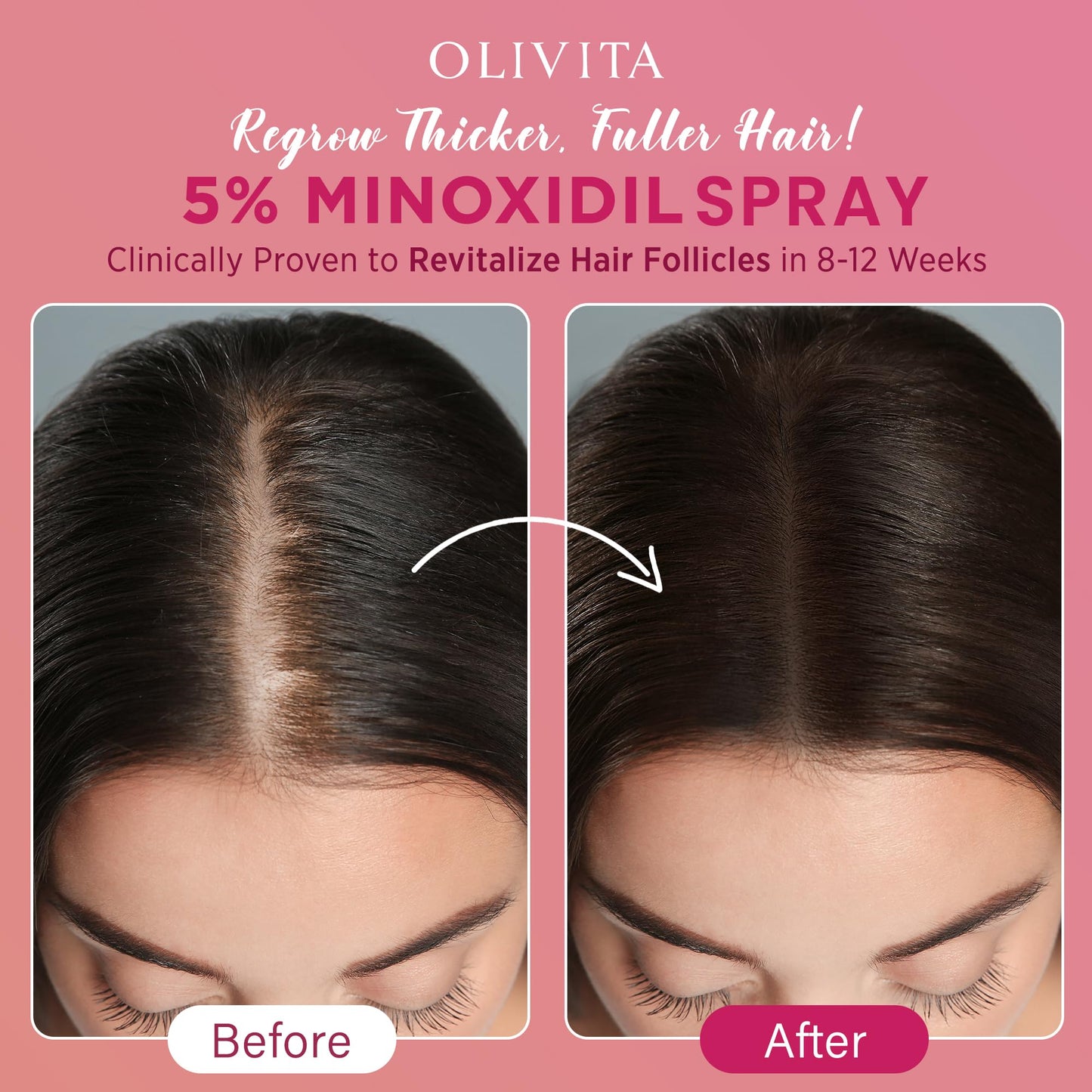 5% Minoxidil Spray for Women Hair Growth: Extra Strength Hair Regrowth Treatment - Revitalize Hair Follicles & Regrow Thicker, Fuller Hair - Hair Loss Beauty and Personal Care OLIVITA