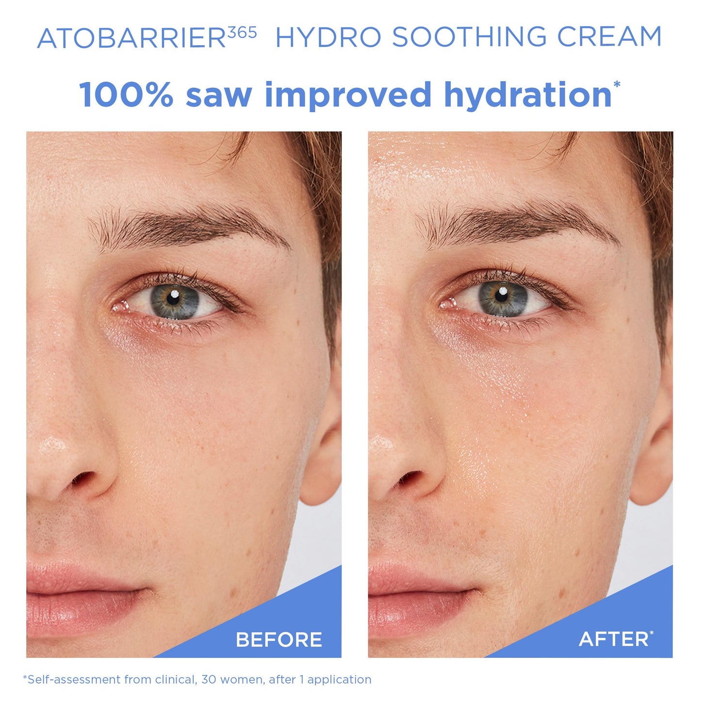AESTURA ATOBARRIER365 Hydro Soothing Gel Cream Moisturizer with Ceramides for Moisture Barrier Repair | Lightweight Hydration, Instant Cooling Beauty and Personal Care AESTURA
