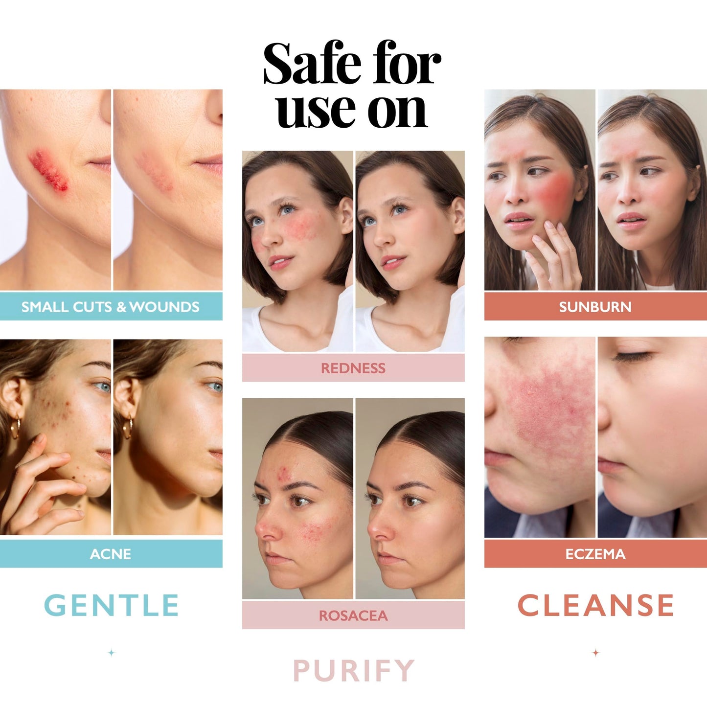 Hypochlorous Acid Spray for Face and Skin; Facial Cleanser | 4oz Face Mist Hypochlorous Acid Spray for Skin, Acne, Rash, Eczema, Wound | Antimicrobial Beauty and Personal Care Aquia