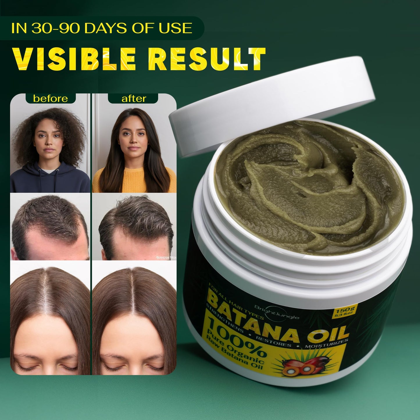 BRIGHTJUNGLE Raw Batana Oil for Hair Growth - Hair & Scalp Oil for Thickness & Shine - Men & Women - 100% Pure, Organic, Cold-Pressed 5.3oz (150g)