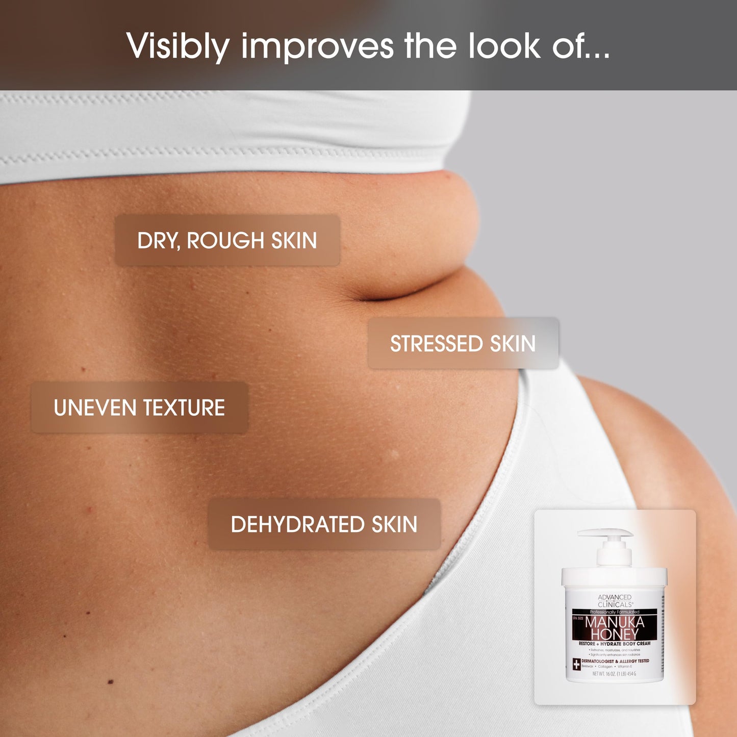 Advanced Clinicals Manuka Honey Body Cream For Women & Men | Body Butter Lotion For Extremely Dry Skin | Collagen Cream