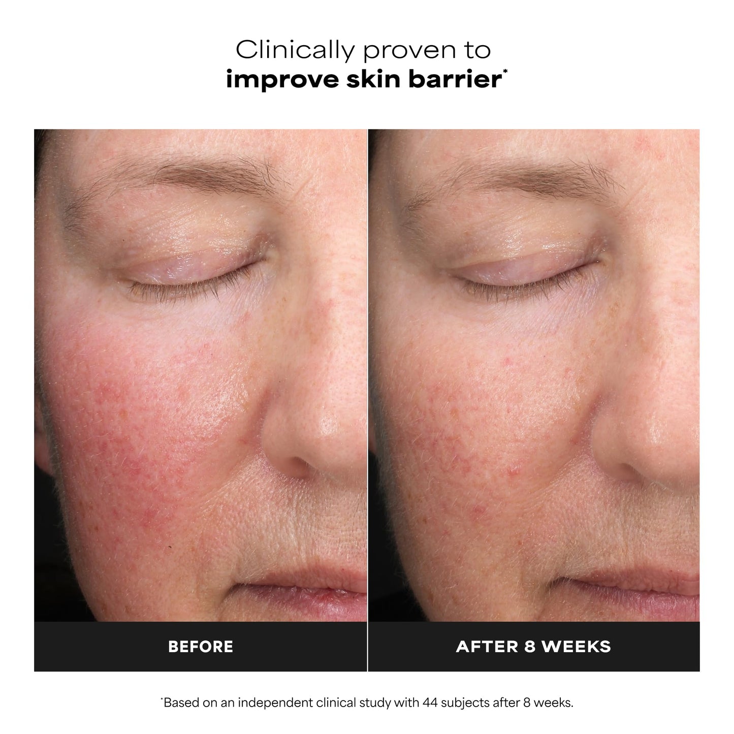 Paula’s Choice 6% Mandelic Acid + 2% Lactic Acid Exfoliant, Gentle Daily AHA Exfoliation for Discoloration, Bumpy Texture & Radiance, for Sensitive Beauty and Personal Care Paula's Choice
