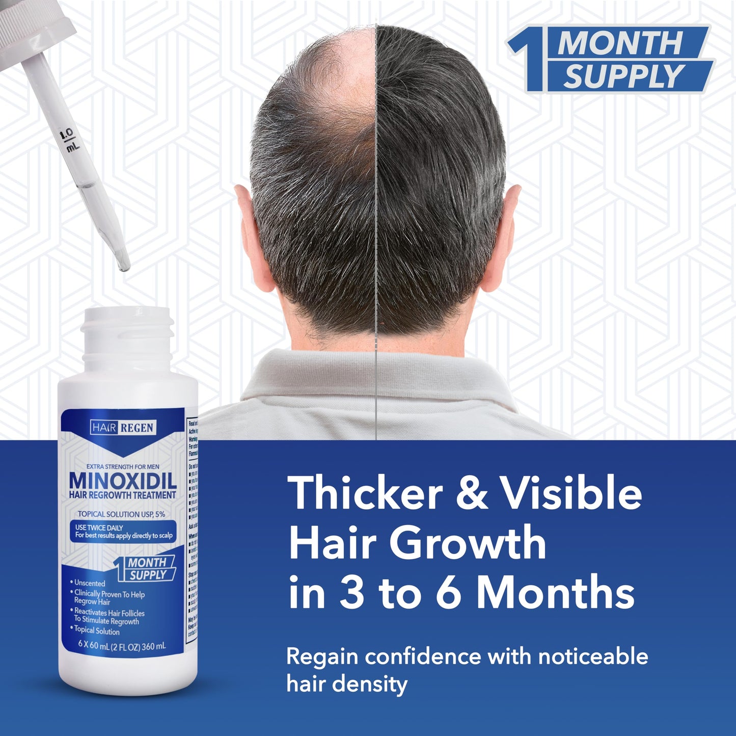 Hair Regen Liquid Minoxidil for Men 5% - Advanced Topical Solution for Regrowth - Growth Treatment for Men Hair Loss 6-Pack as 6-Month Supply Kit Beauty and Personal Care Hair Regen