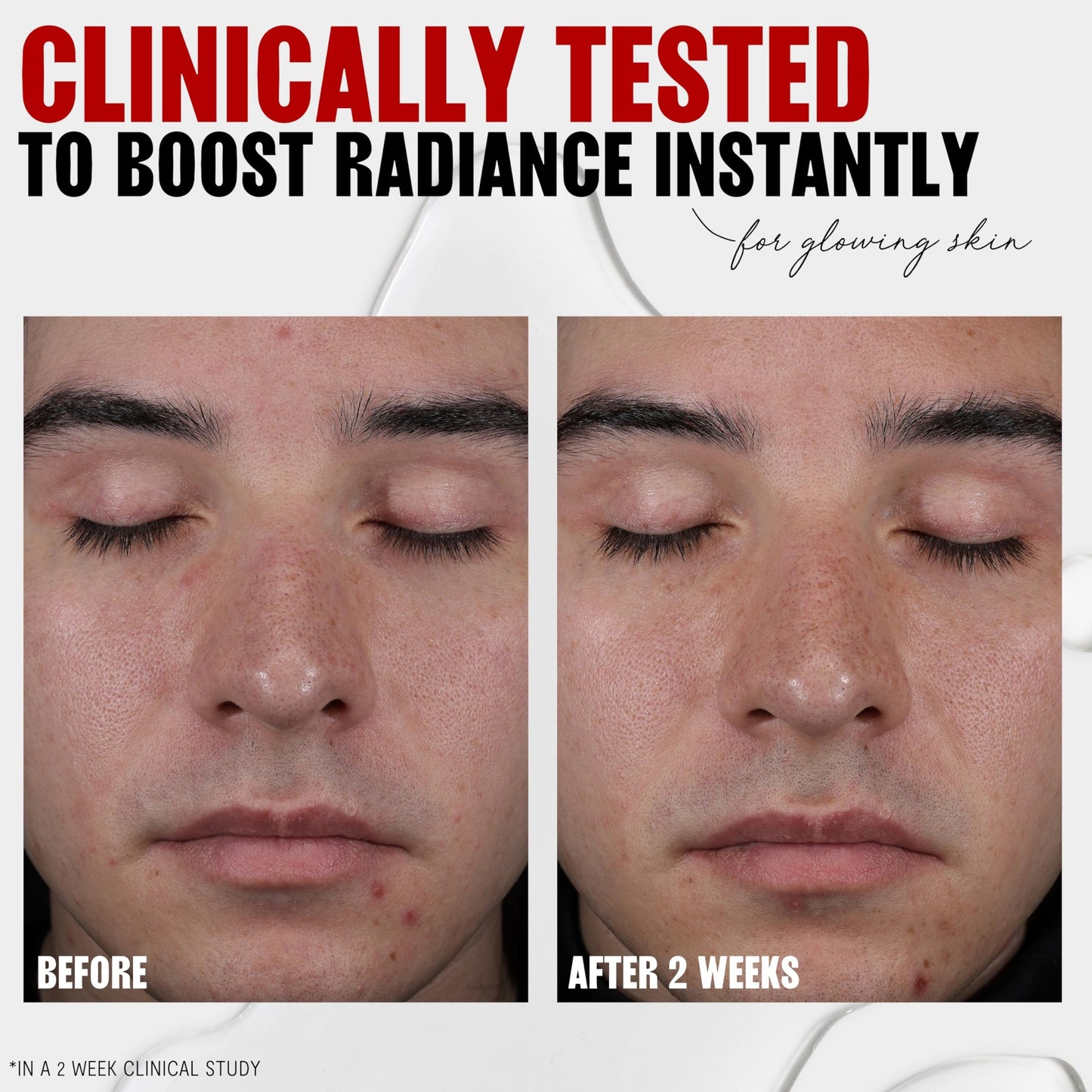 Thayers 2% AHA Exfoliating and Brightening Toner with Glycolic Acid, Lactic Acid and Witch Hazel, Smoothing and Pore Refining Skin Care for All Skin