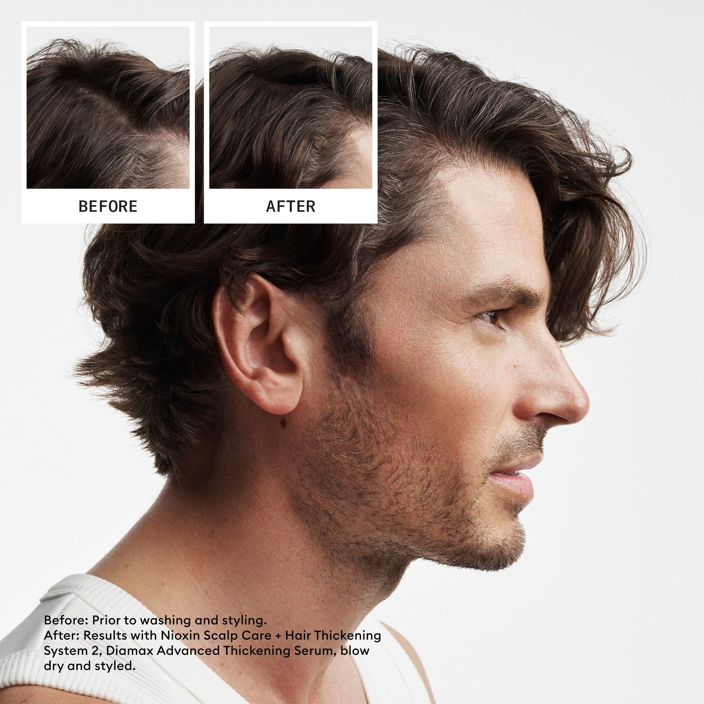 NIOXIN System 2 Scalp Care | Conditioner | Hair Thickening For Natural Hair Beauty and Personal Care NIOXIN