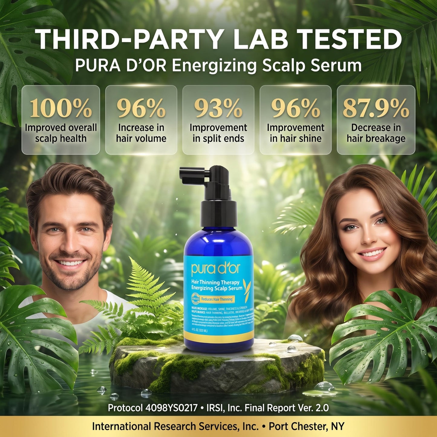 PURA D'OR Hair Thinning Therapy Energizing Scalp Serum 4oz w/Copper Tripeptide, Biotin, Caffeine, Plant Stem Cell, Catalase & DHT Balance, Rosemary Beauty and Personal Care PURA D'OR